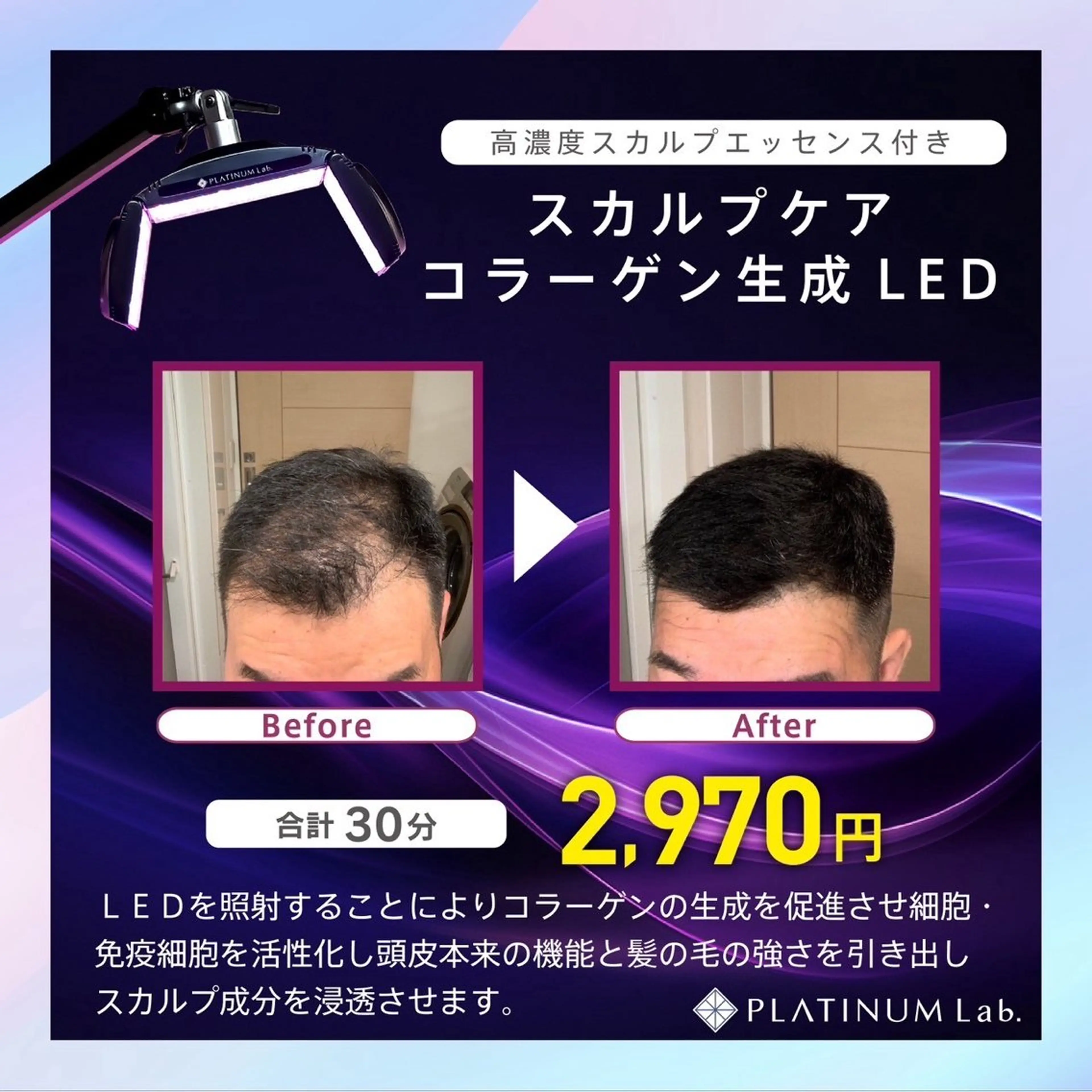 メンズ ヘッドスパ プラチナムビューティー武蔵小山店所属・プラチナム ビューティー武蔵小山のその他イメージ