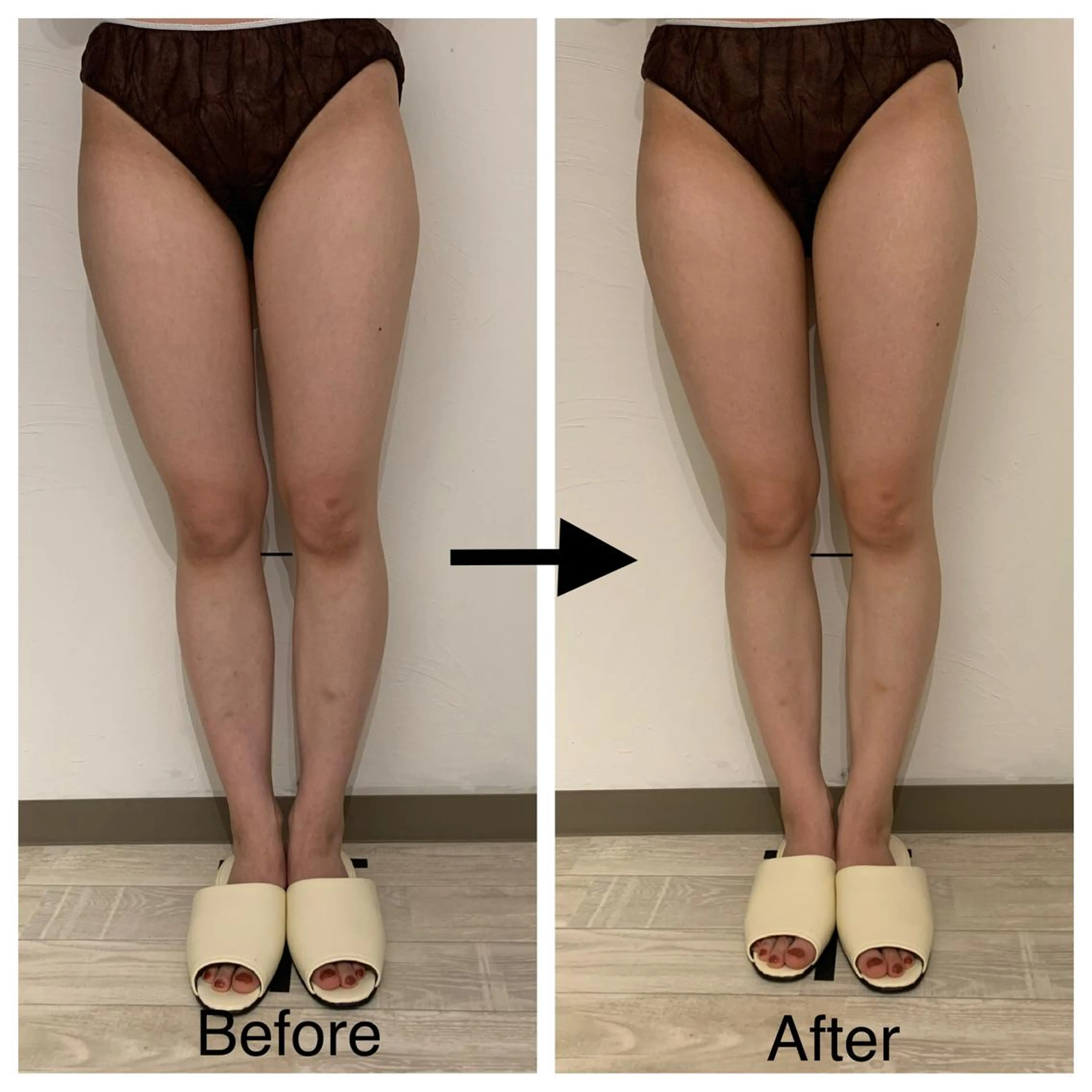 リンパマッサージ&ピラティスmimoza所属・リンパマッサージ mimozaのエステ・リラクイメージ