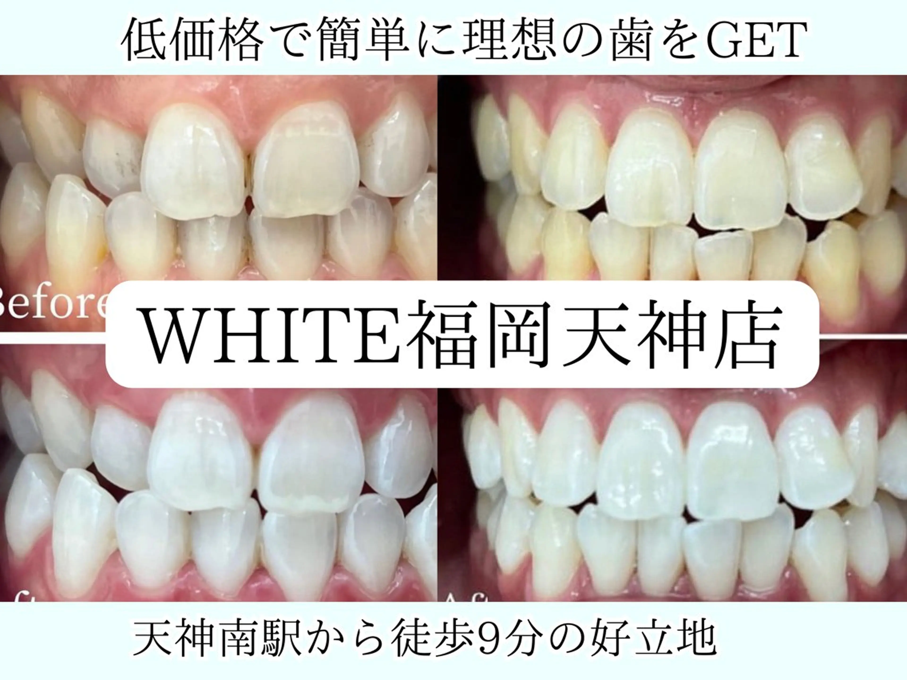 メンズ エステ リラク ホワイトニング専門店 WHITE天神店のエステ・リラクイメージ