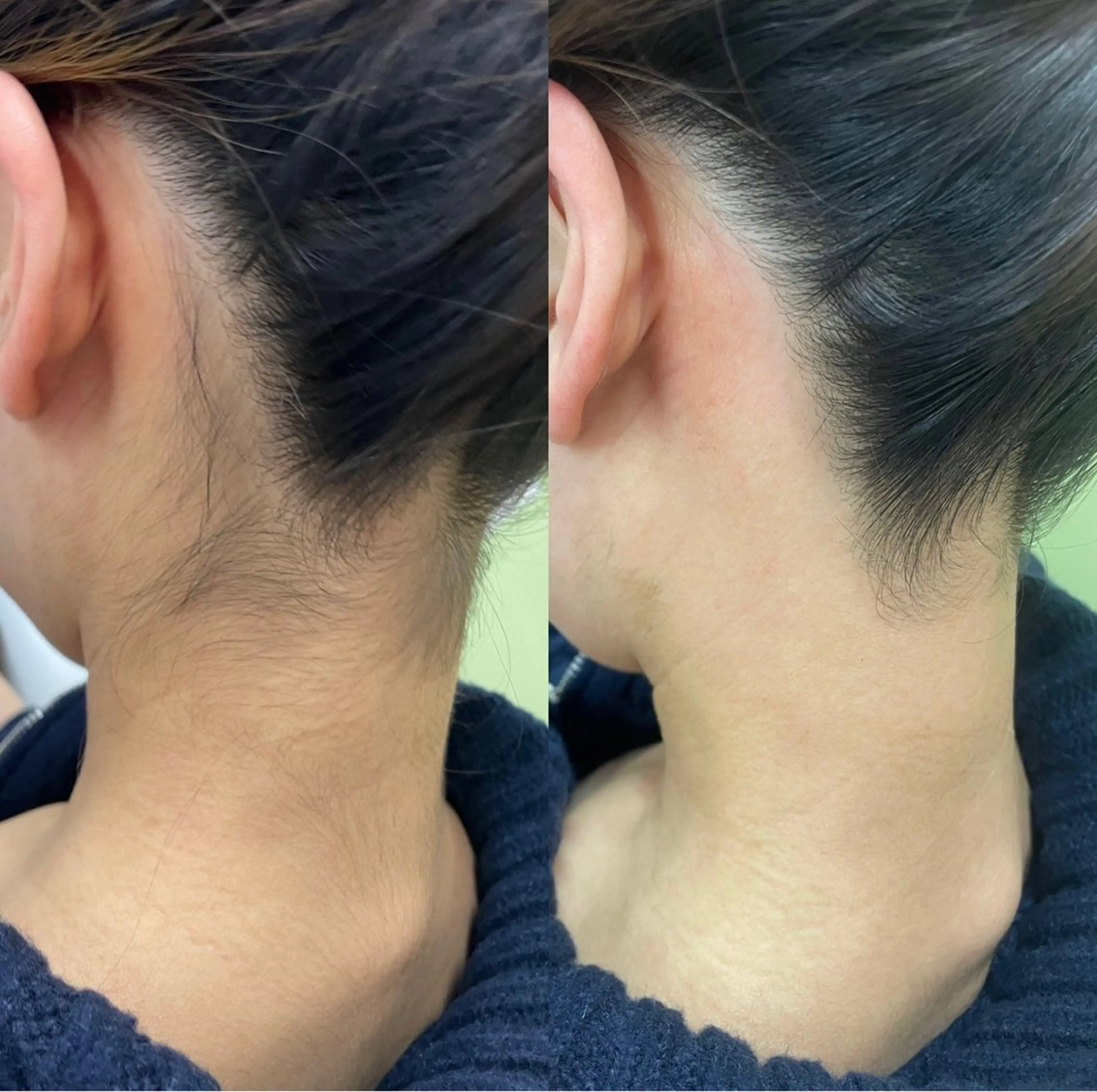 アイブロウ 眉毛ワックス脱毛 signpost 鈴木のマツエク・マツパデザイン