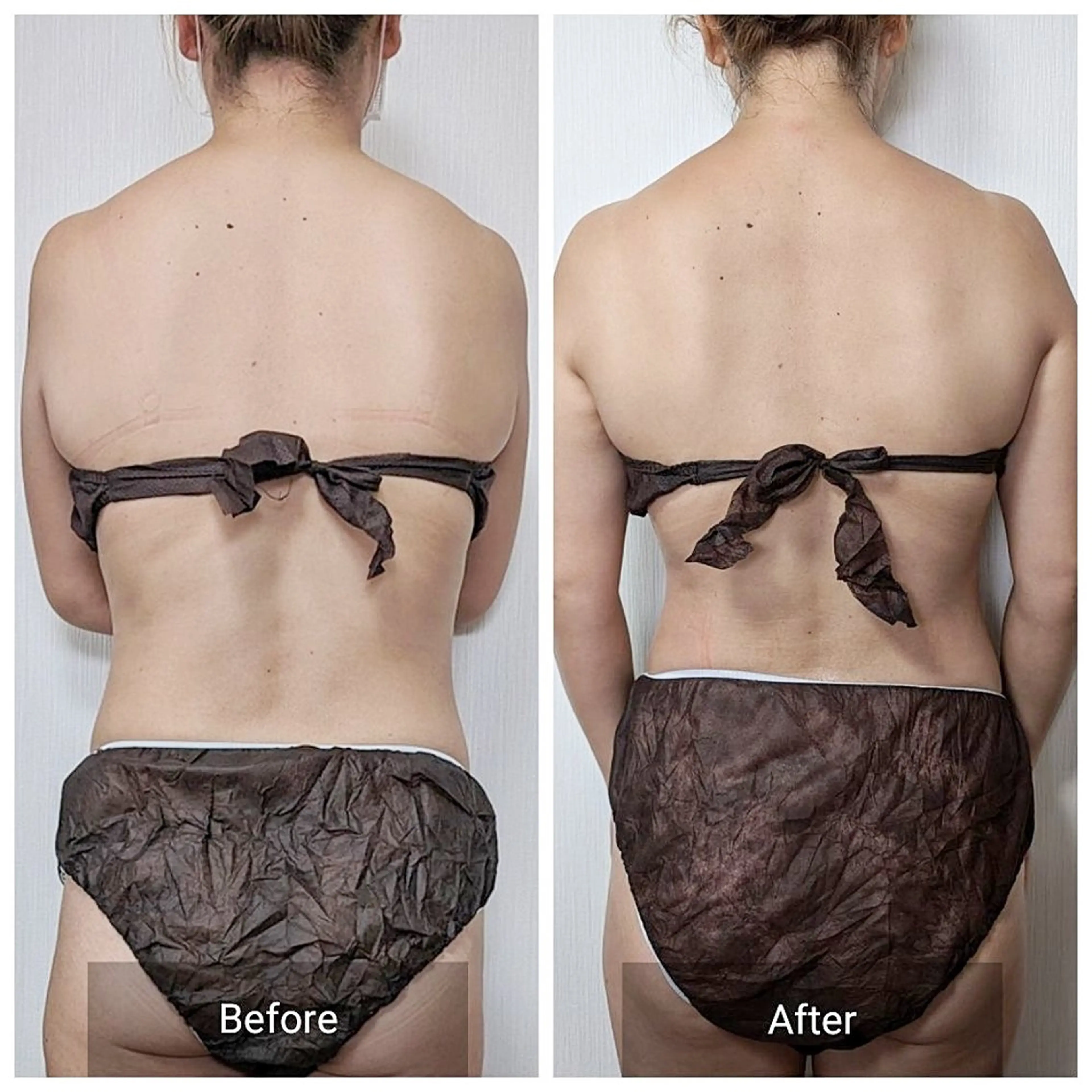 エステ nail RiRi アトレナチュラのエステ・リラクイメージ