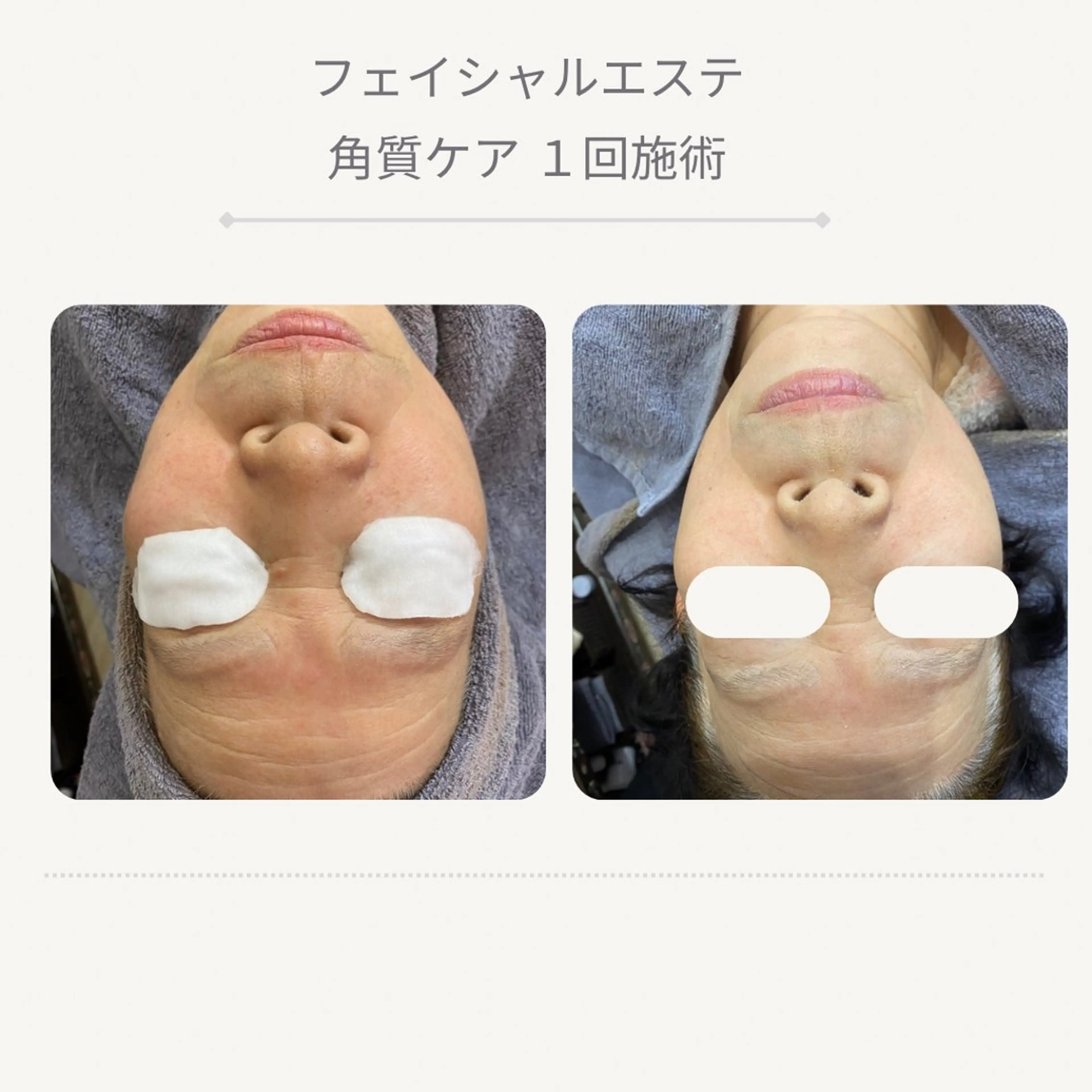 エステ -maju- Ayumiのエステ・リラクイメージ