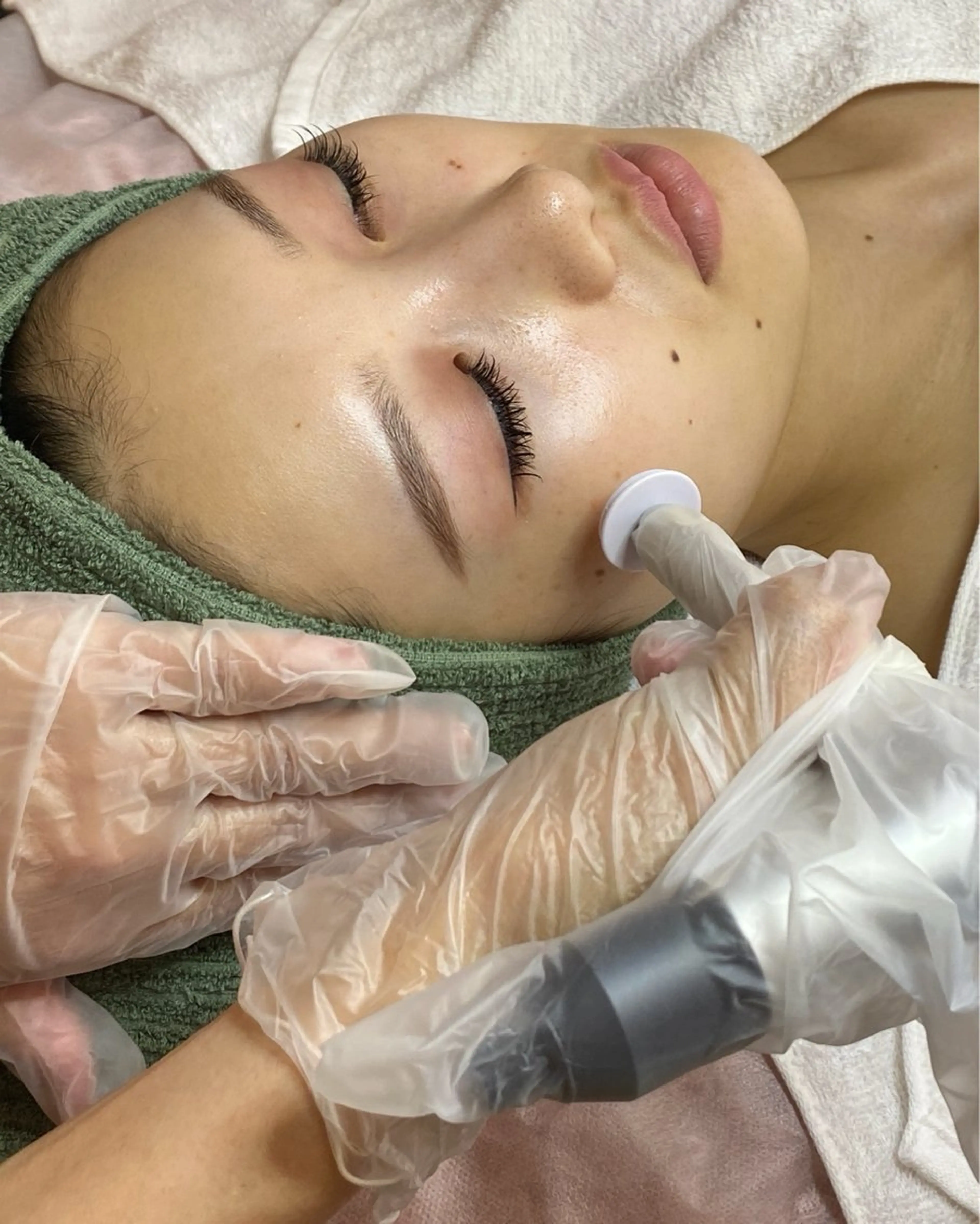 プロセルセラピーズ　お顔の写真