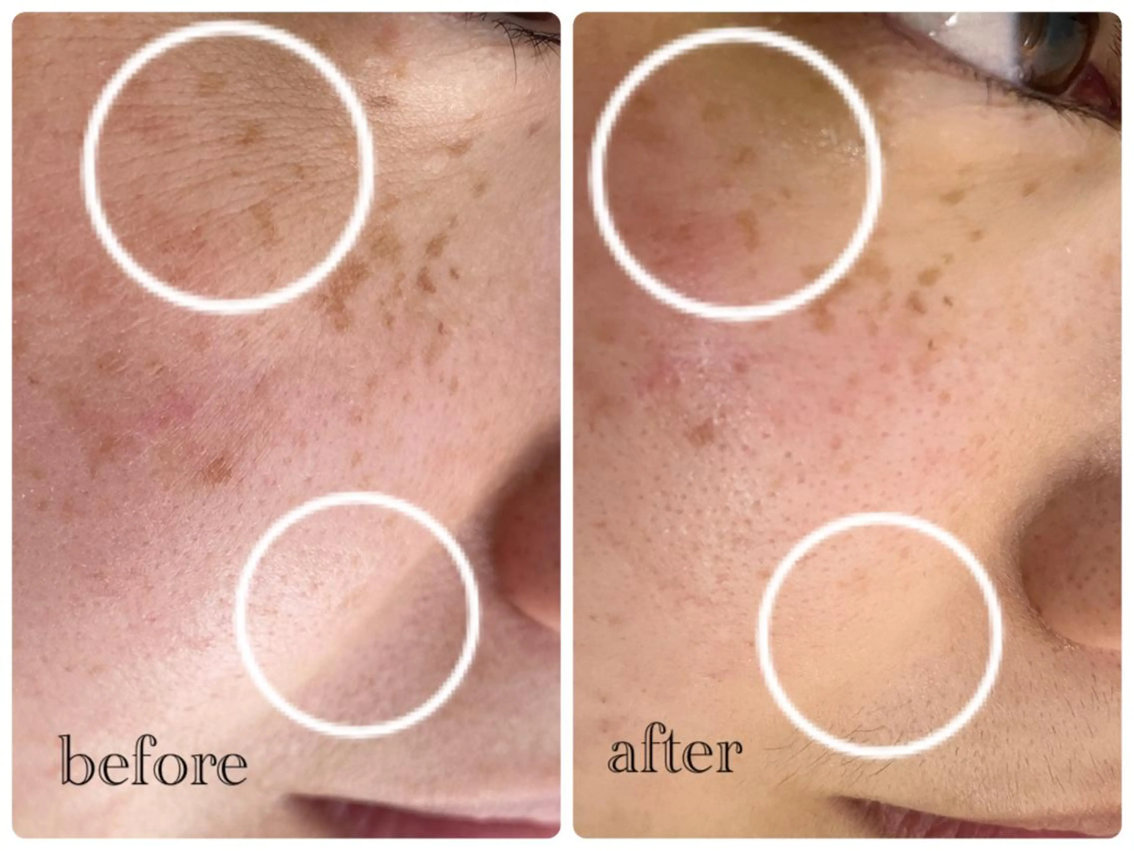 デ・アイム新潟北所属・サイトウ .のエステ・リラクイメージ