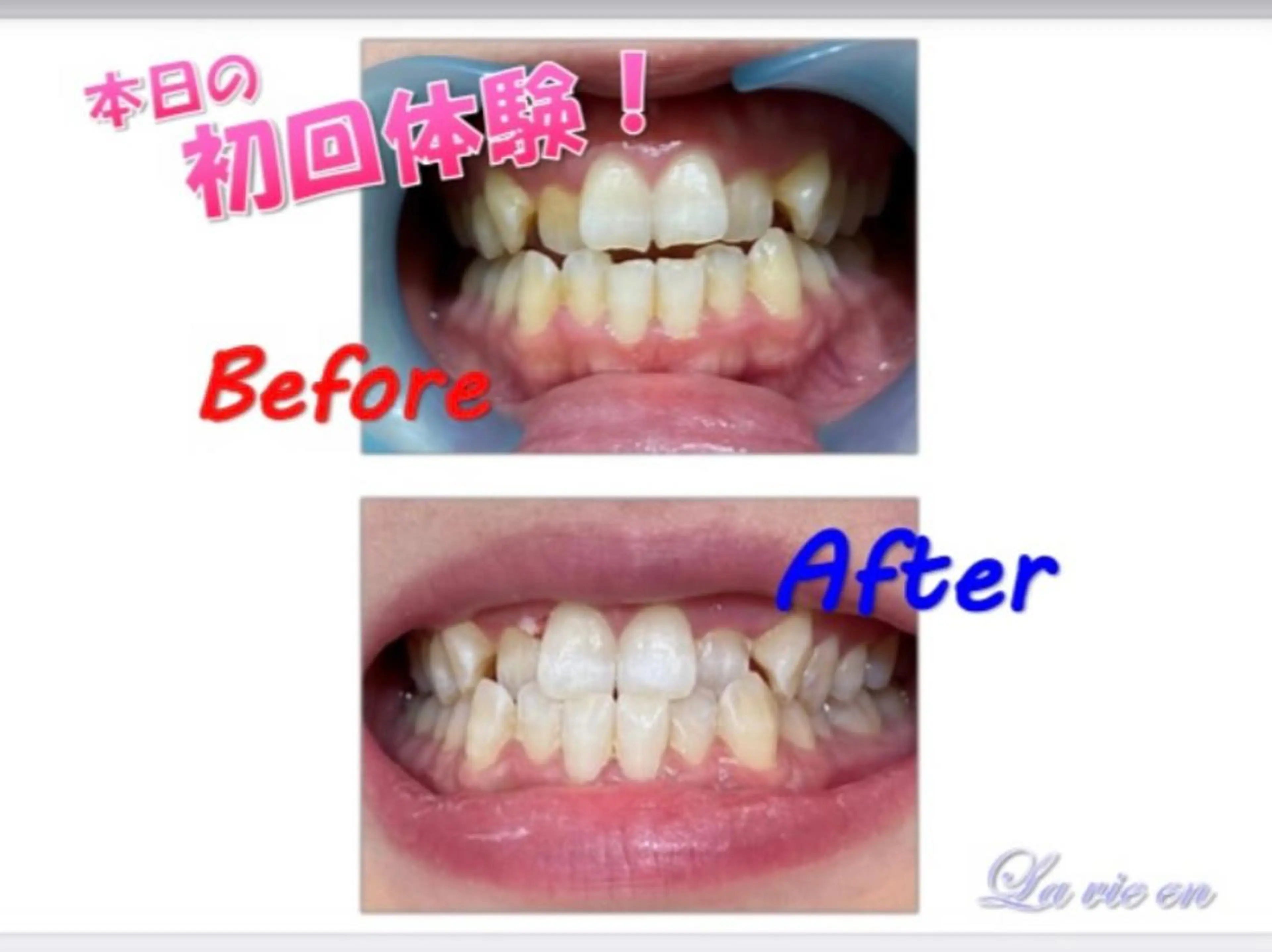 その他 セルフホワイトニングサロン　ラヴィアン所属・ホワイトニングサロン La vie enのその他イメージ