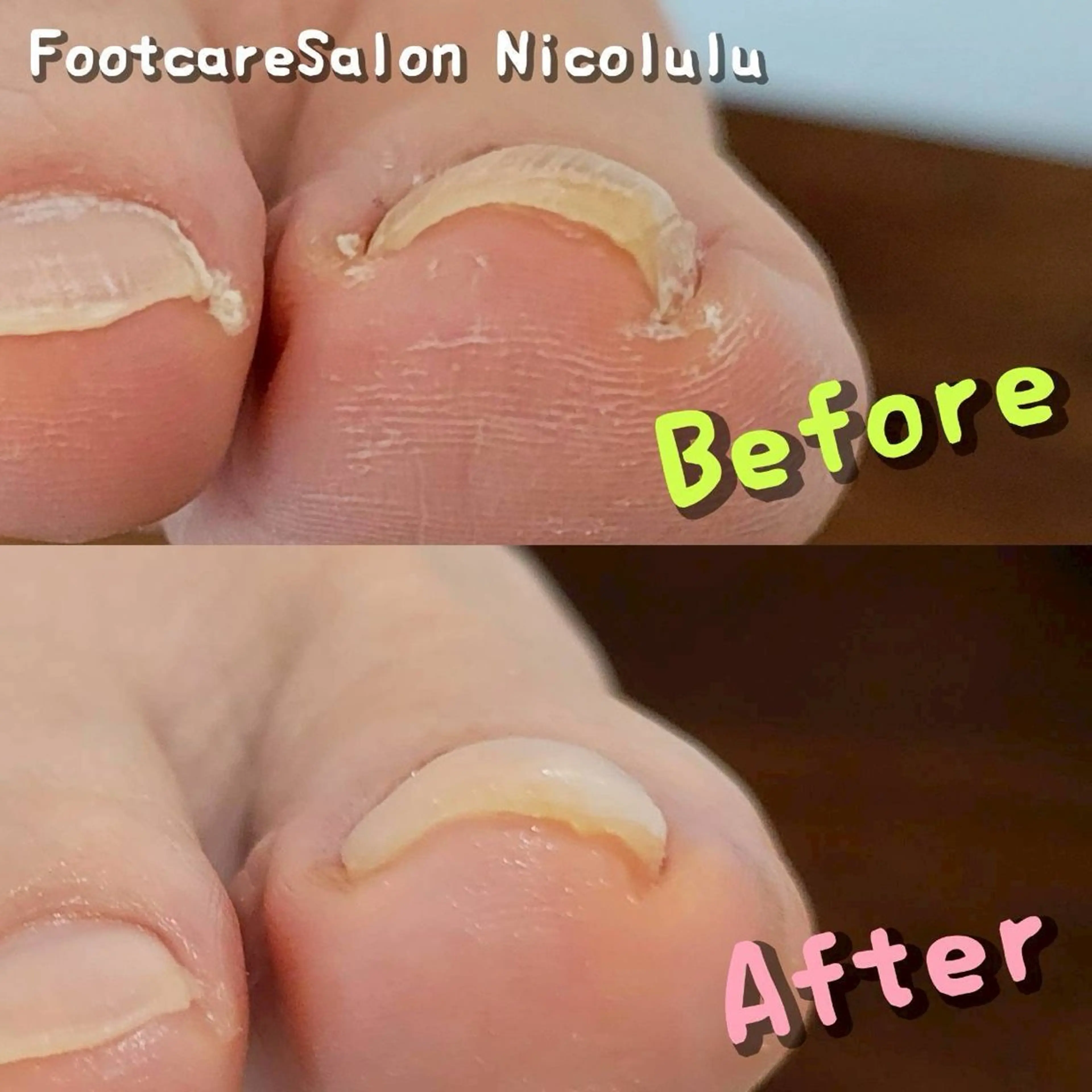 リラク 足トラブル専門 ニコルル金沢のエステ・リラクイメージ