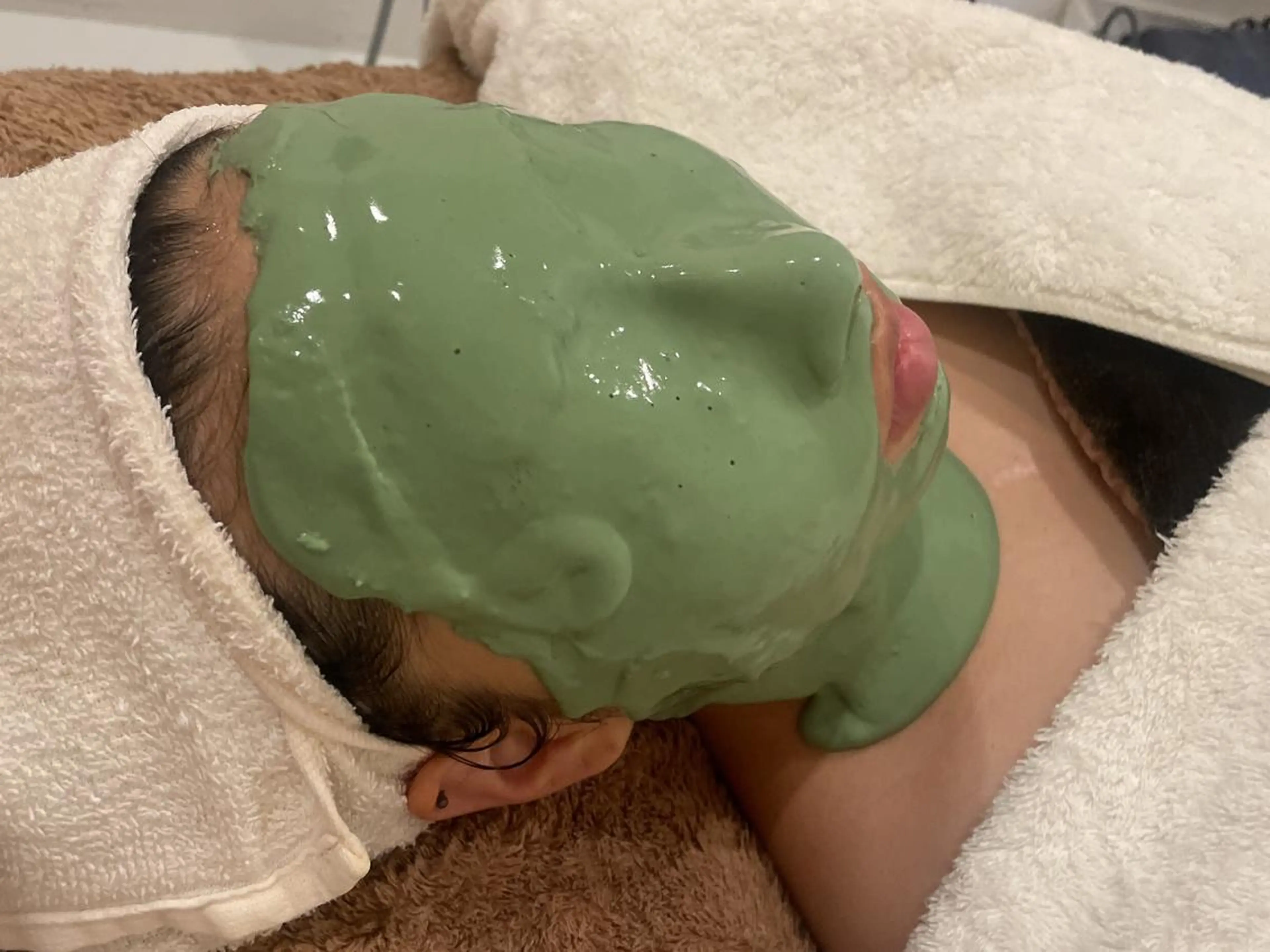 💚花粉やマスク荒れ、ニキビにおススメケア💚リーズナブルな価格で人気No.1！『アドバンスコース+ビューネケアパック』の写真