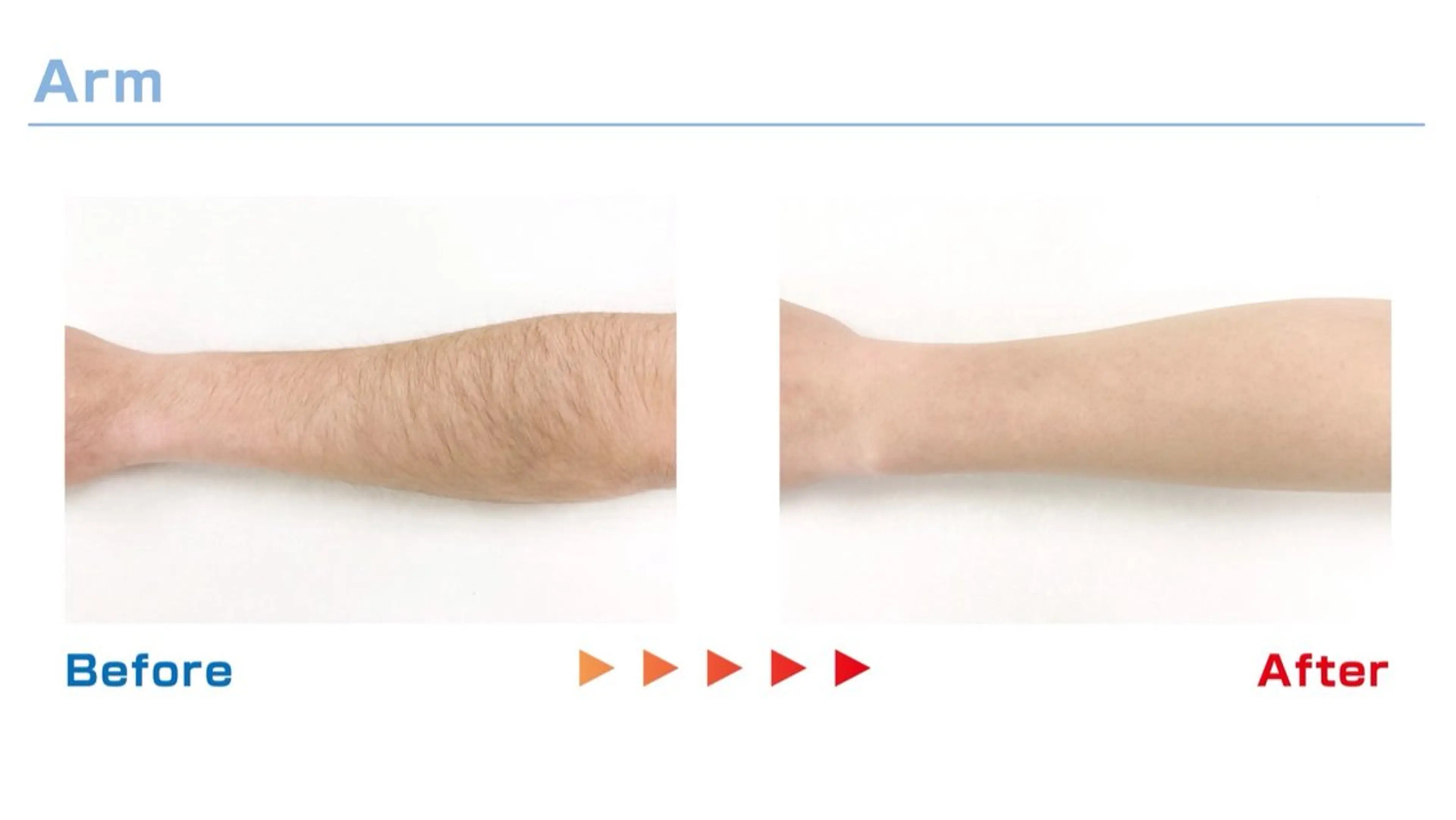 MOCO所属・脱毛サロン moco selfのエステ・リラクイメージ