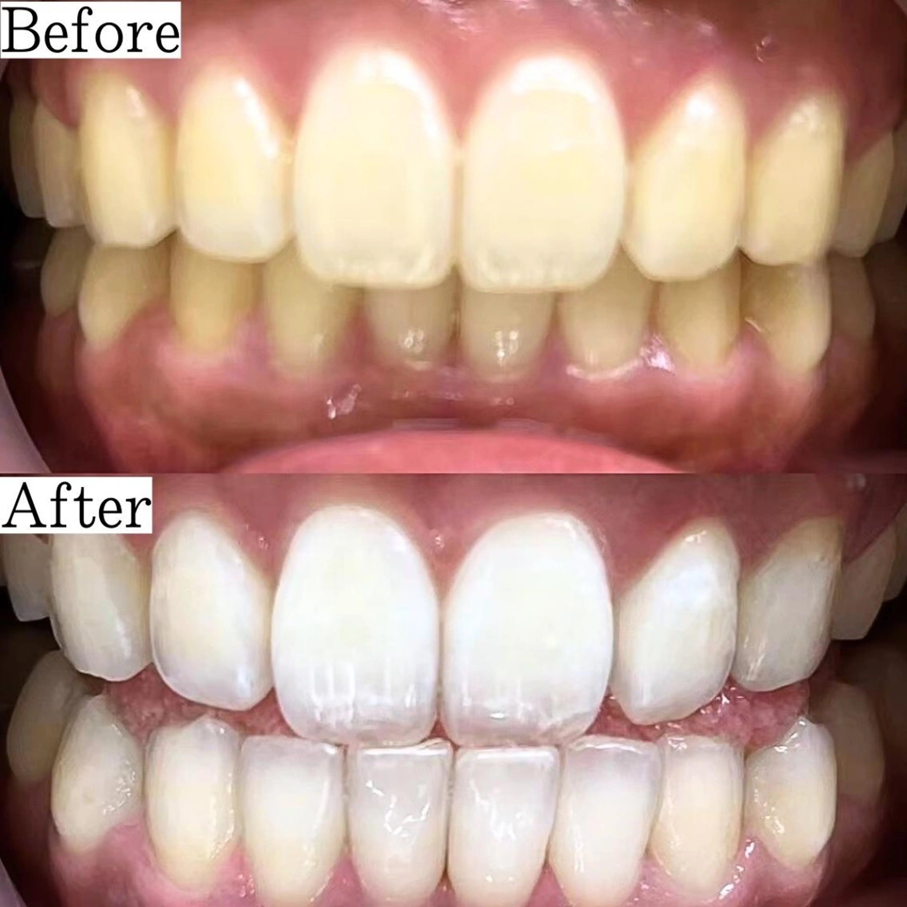 その他 LBSホワイトニング 銀座店💎店長浦和のその他イメージ