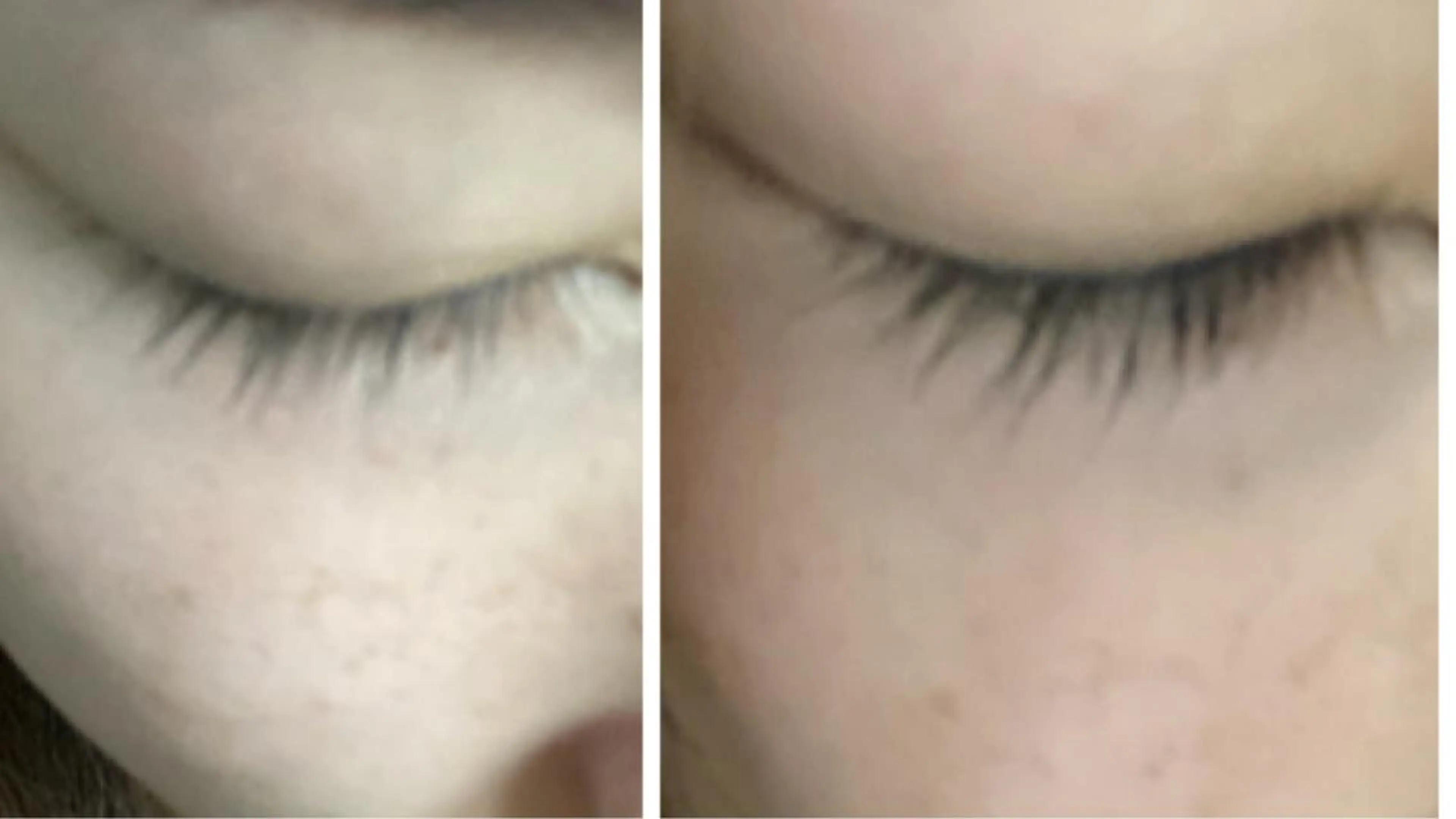 ピーリング専門サロン Spicaのエステ・リラクイメージ