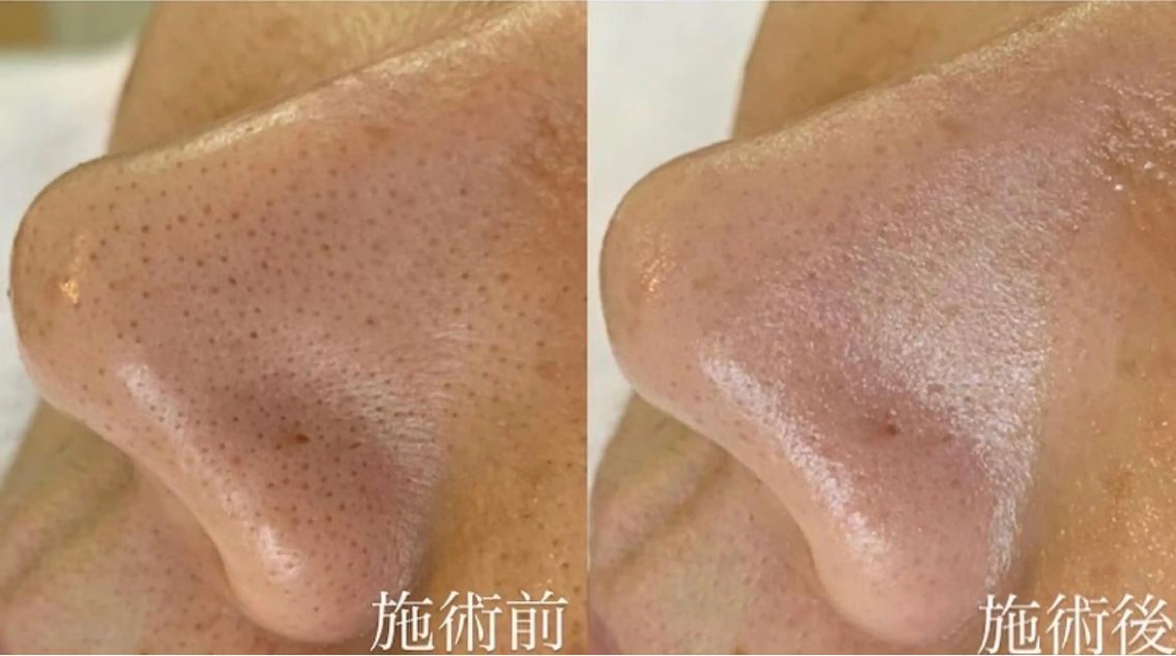 ハーブピーリング専門 muro.のエステ・リラクイメージ