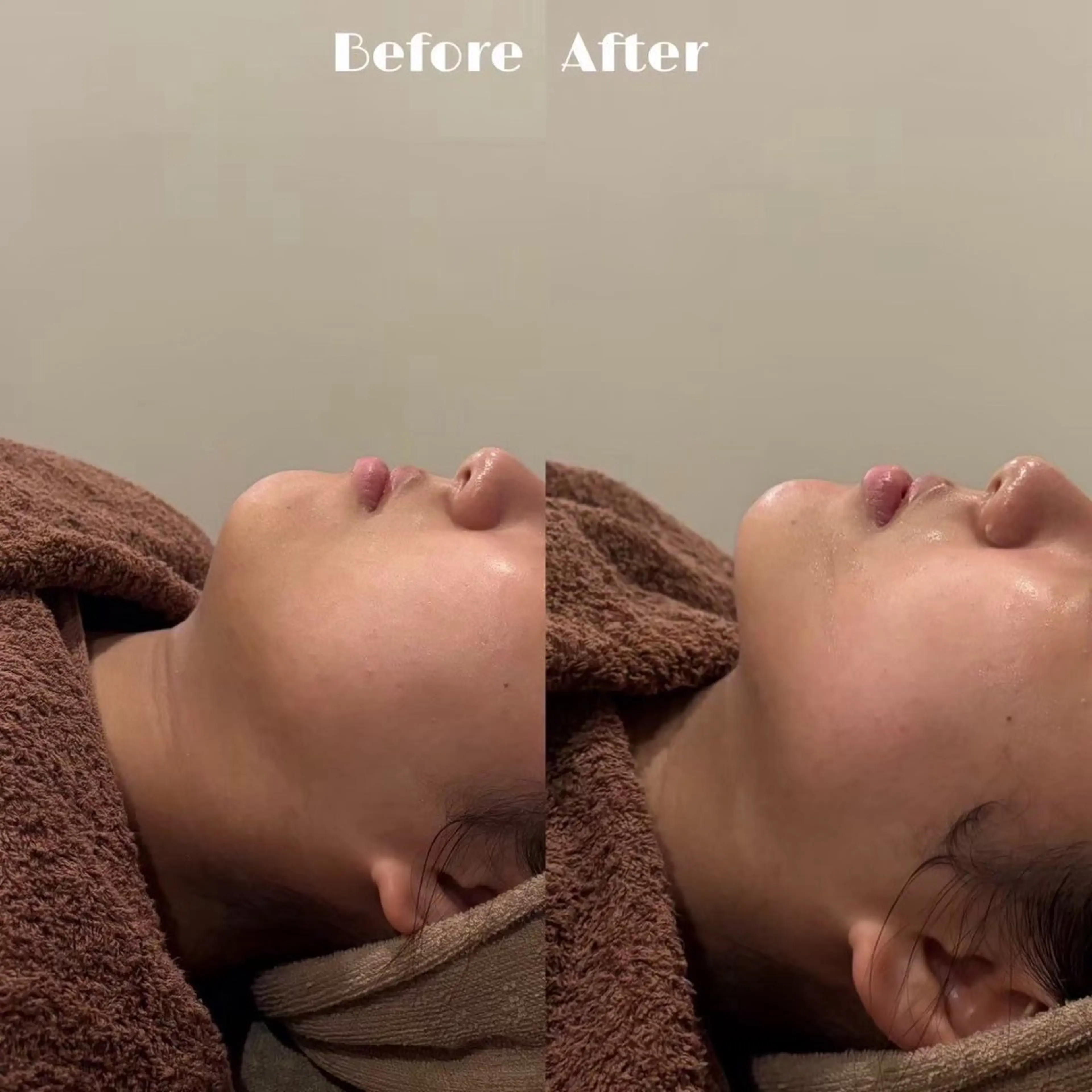 # fu♡のエステ・リラクイメージ