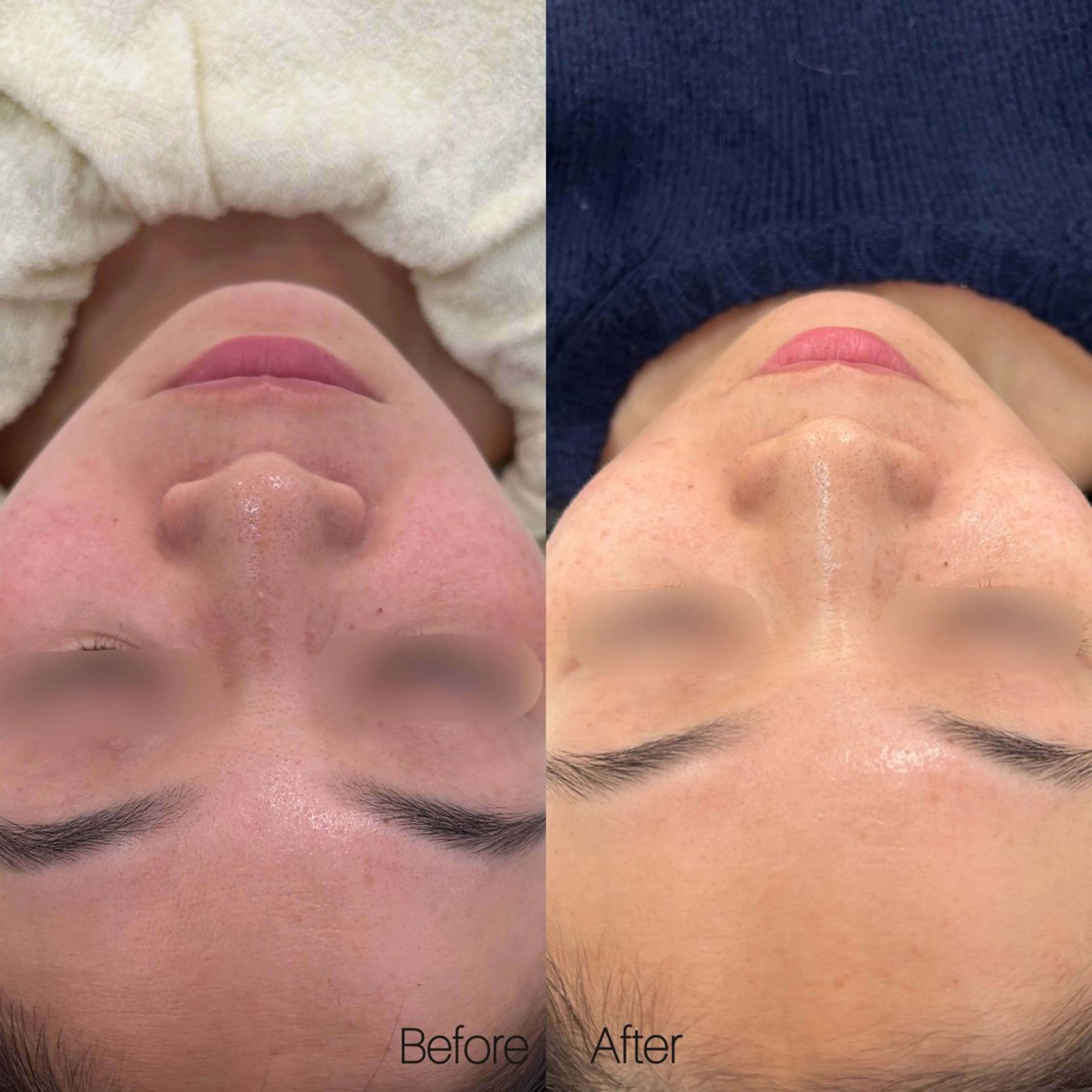 エステ 〈etre〉トータルビューティーサロン所属・etre - 韓国肌管理 -のエステ・リラクイメージ