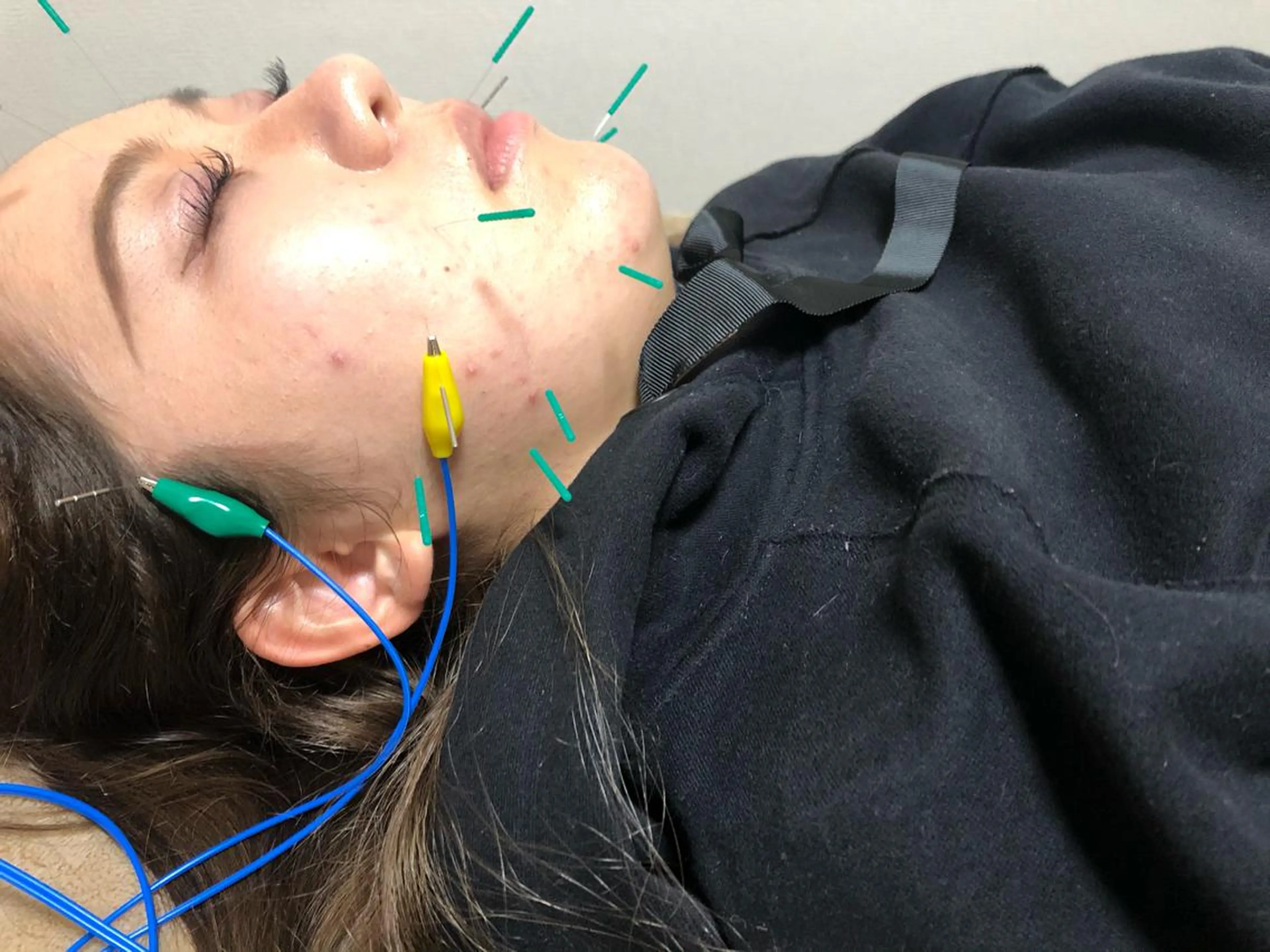 エステ リラク やはた鍼灸整骨院所属・やはた 鍼灸整骨院のエステ・リラクイメージ