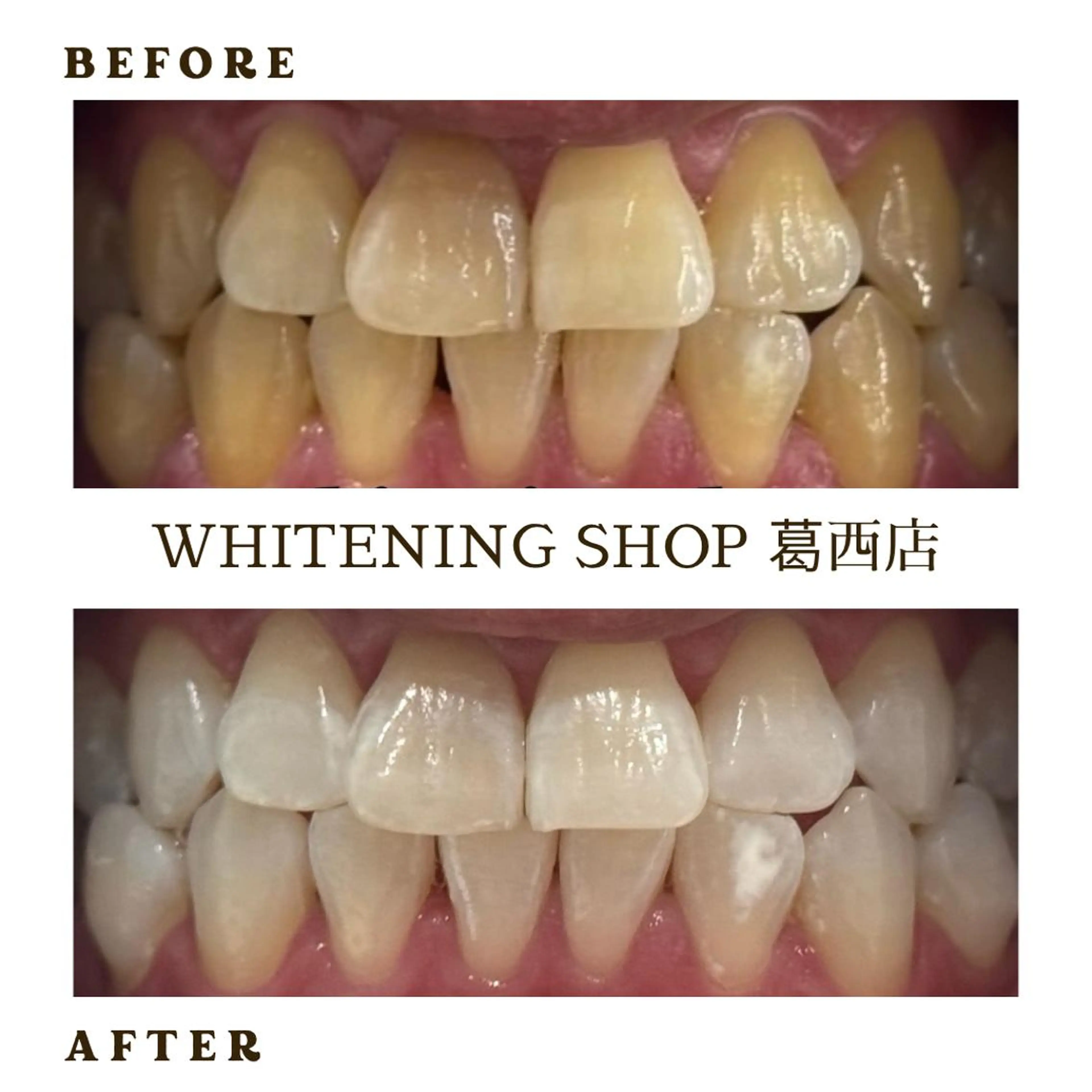 メンズ その他 ホワイトニング ショップ葛西店のその他イメージ