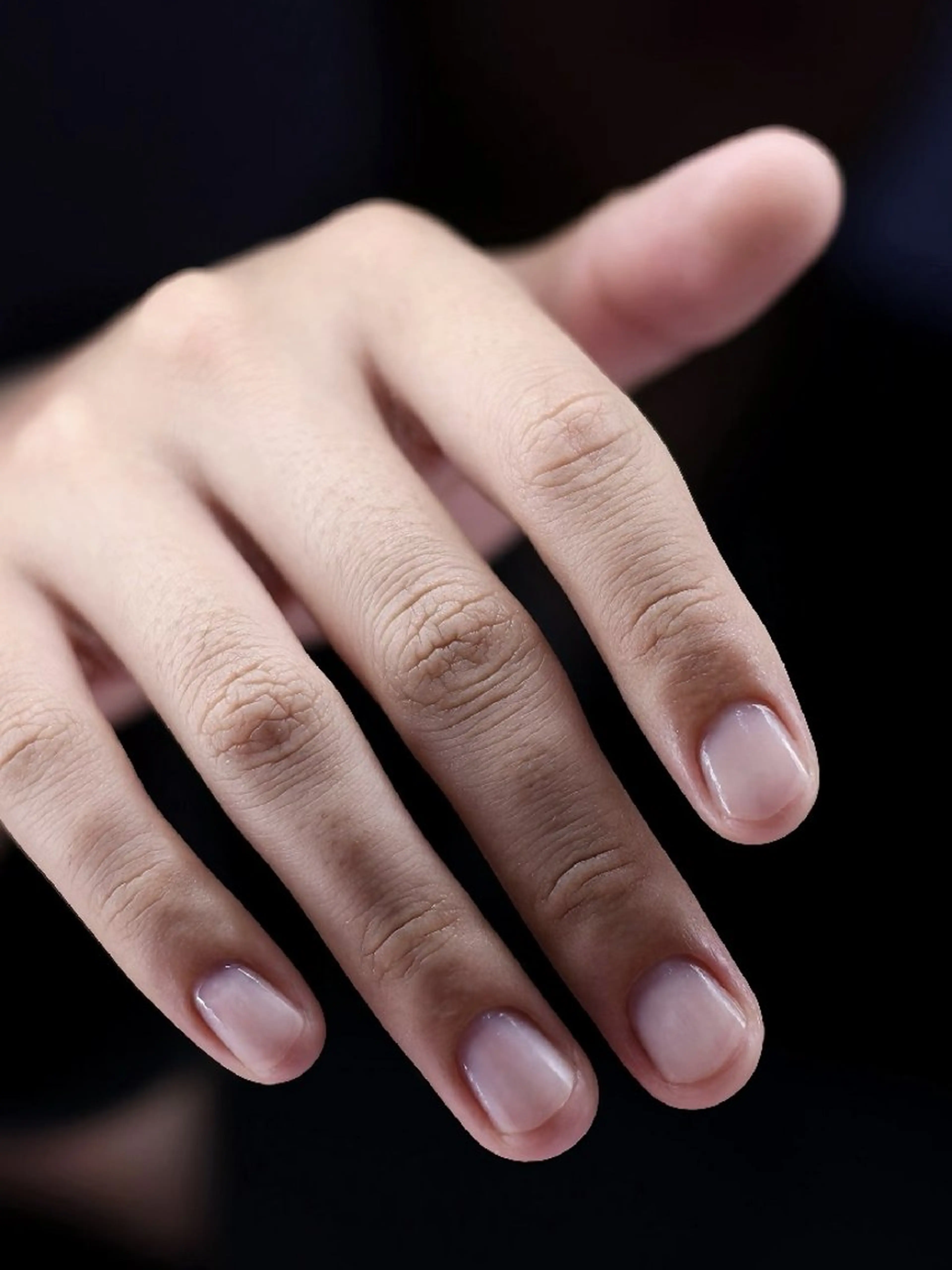 ネイル ハンドケア フィルイン、長さ出し 深爪矯正のネイルデザイン