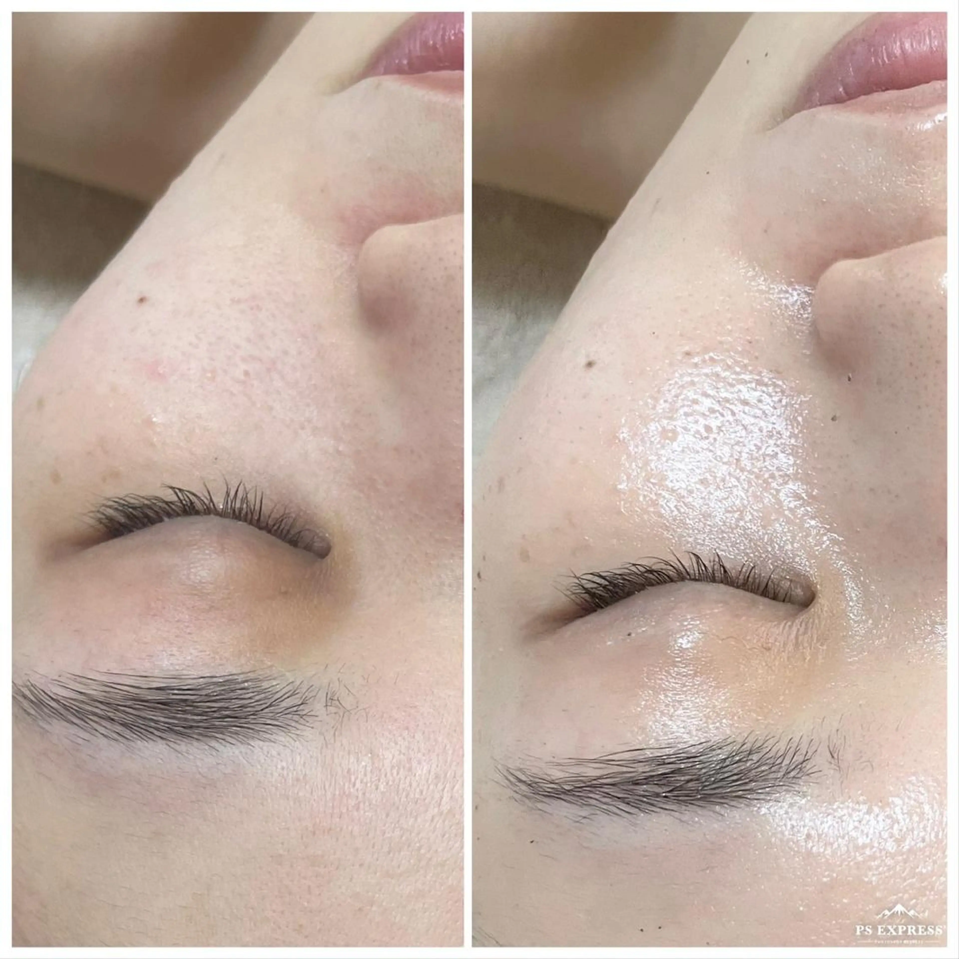 ✨オープン記念✨陶肌トリートメント　ハーブ🌿2g🎁シルクパウダープレゼント🎁の写真