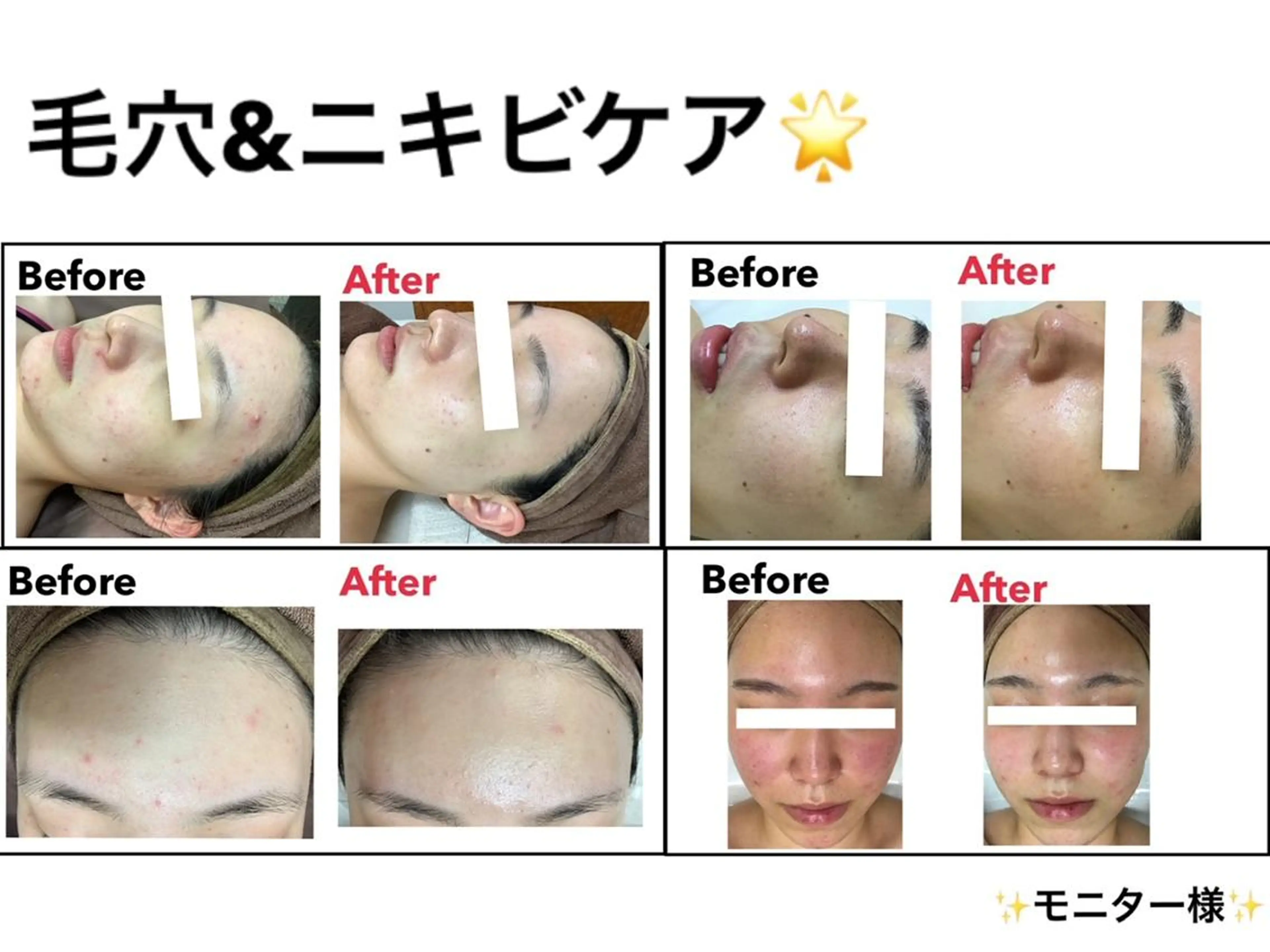 エステ エステティックレイ ビス秋田店　菅野のエステ・リラクイメージ