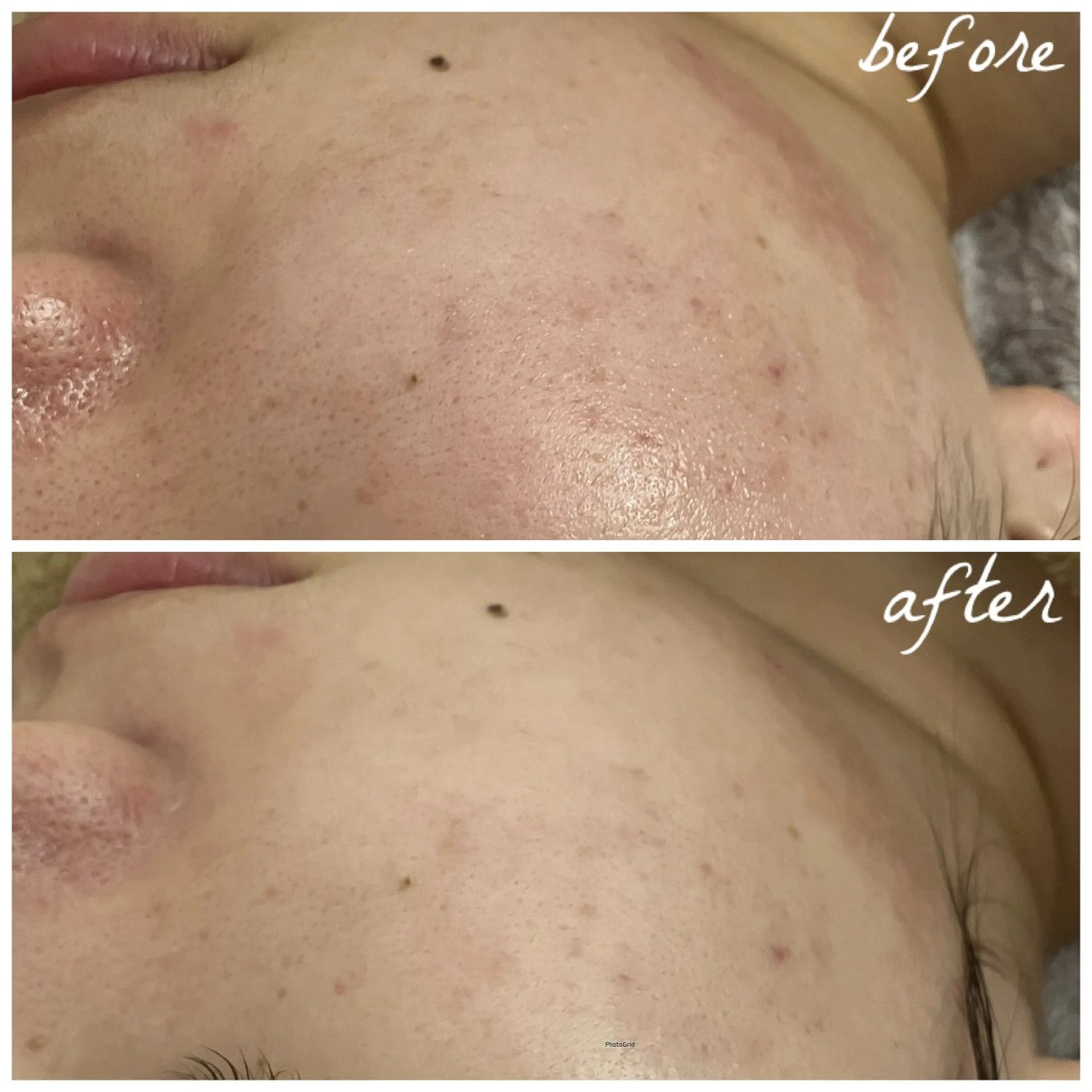 メンズ エステ メナード岐阜茜部 杉浦のエステ・リラクイメージ