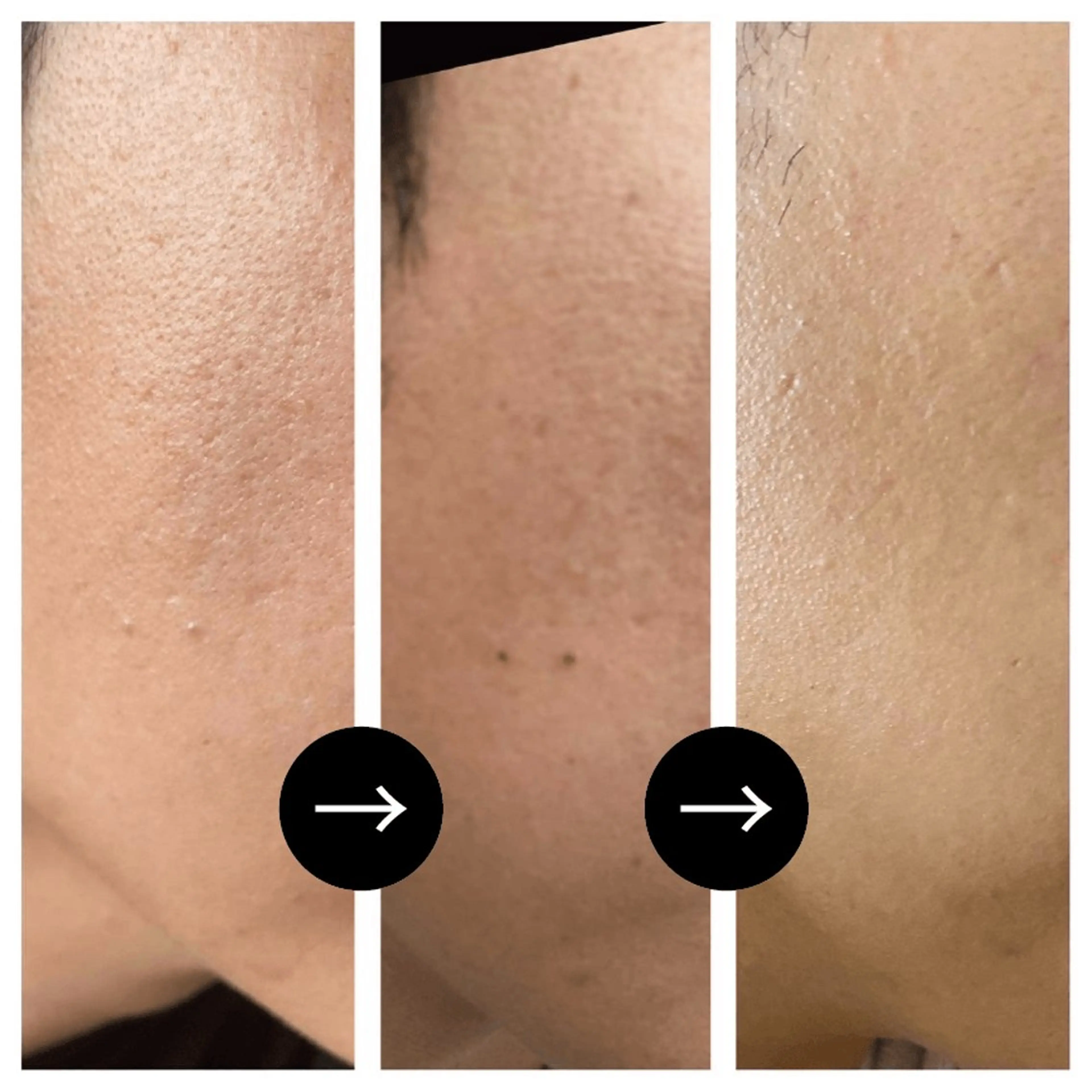 ハーブピーリング専門 muro.のエステ・リラクイメージ