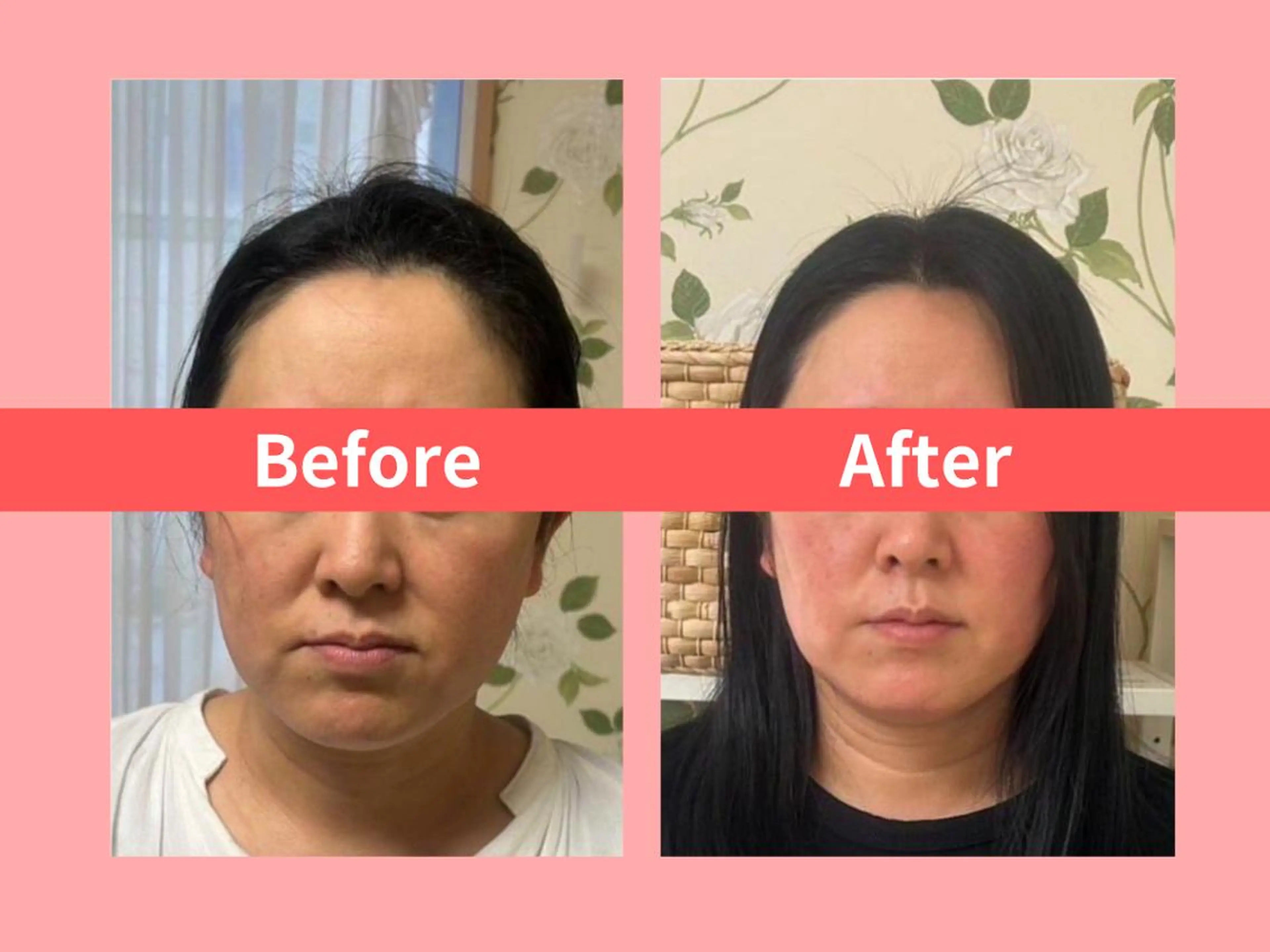 エステ リラク 痩身&小顔矯正専門店 Re:Livesのエステ・リラクイメージ