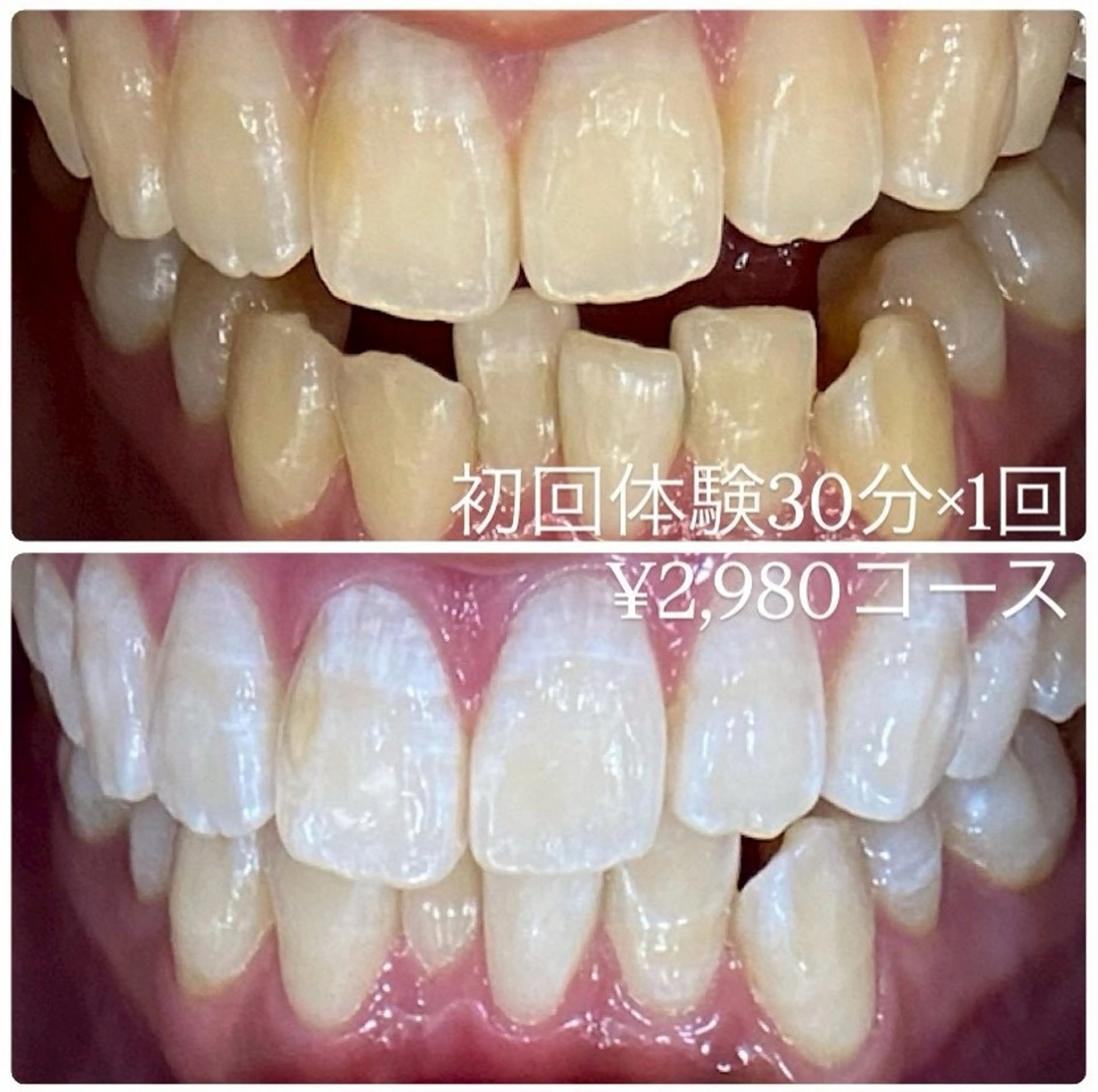 その他 PLATINUM Beauty 横浜店所属・ホワイトニングルーム 横浜店のその他イメージ