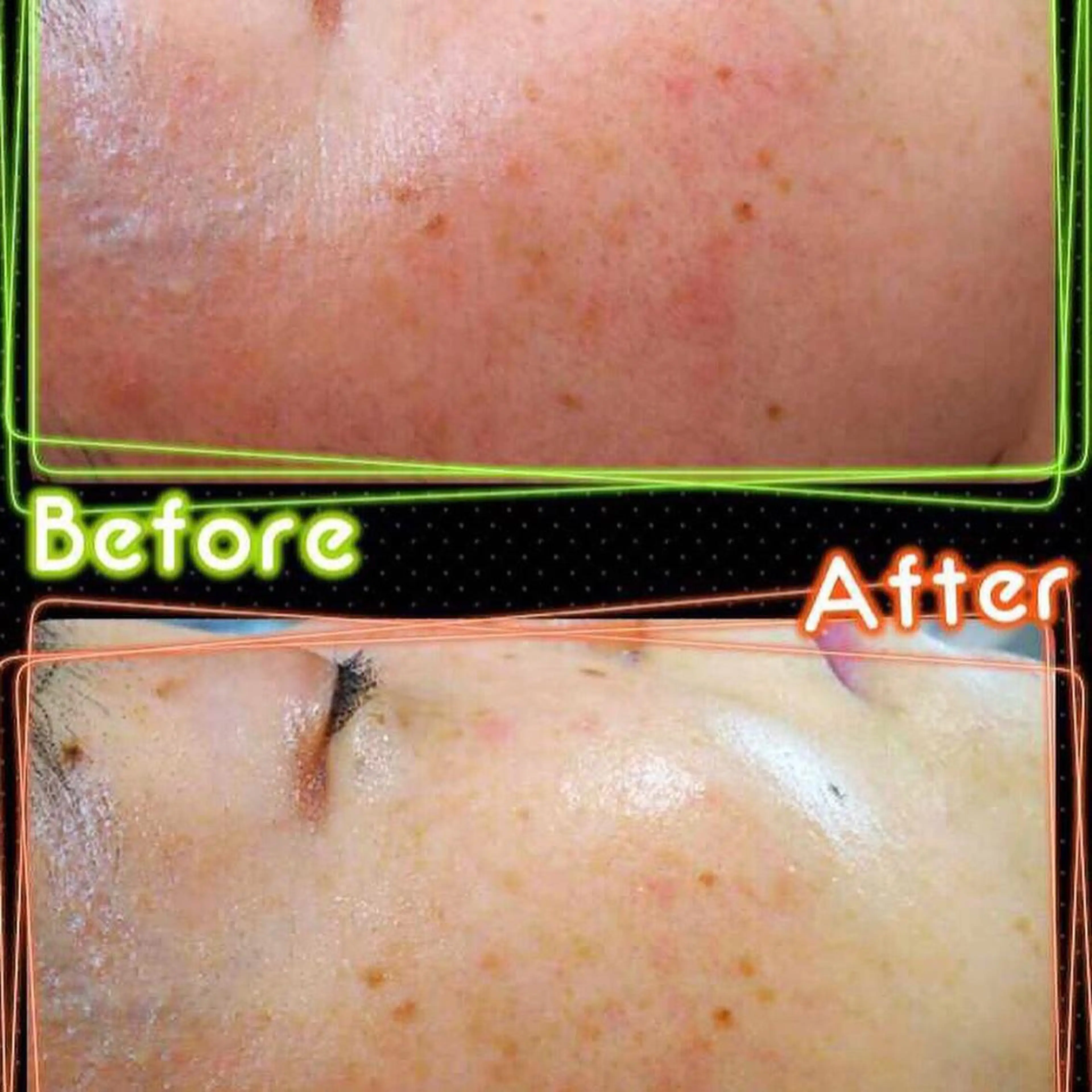 エステ mahalo salonのその他イメージ