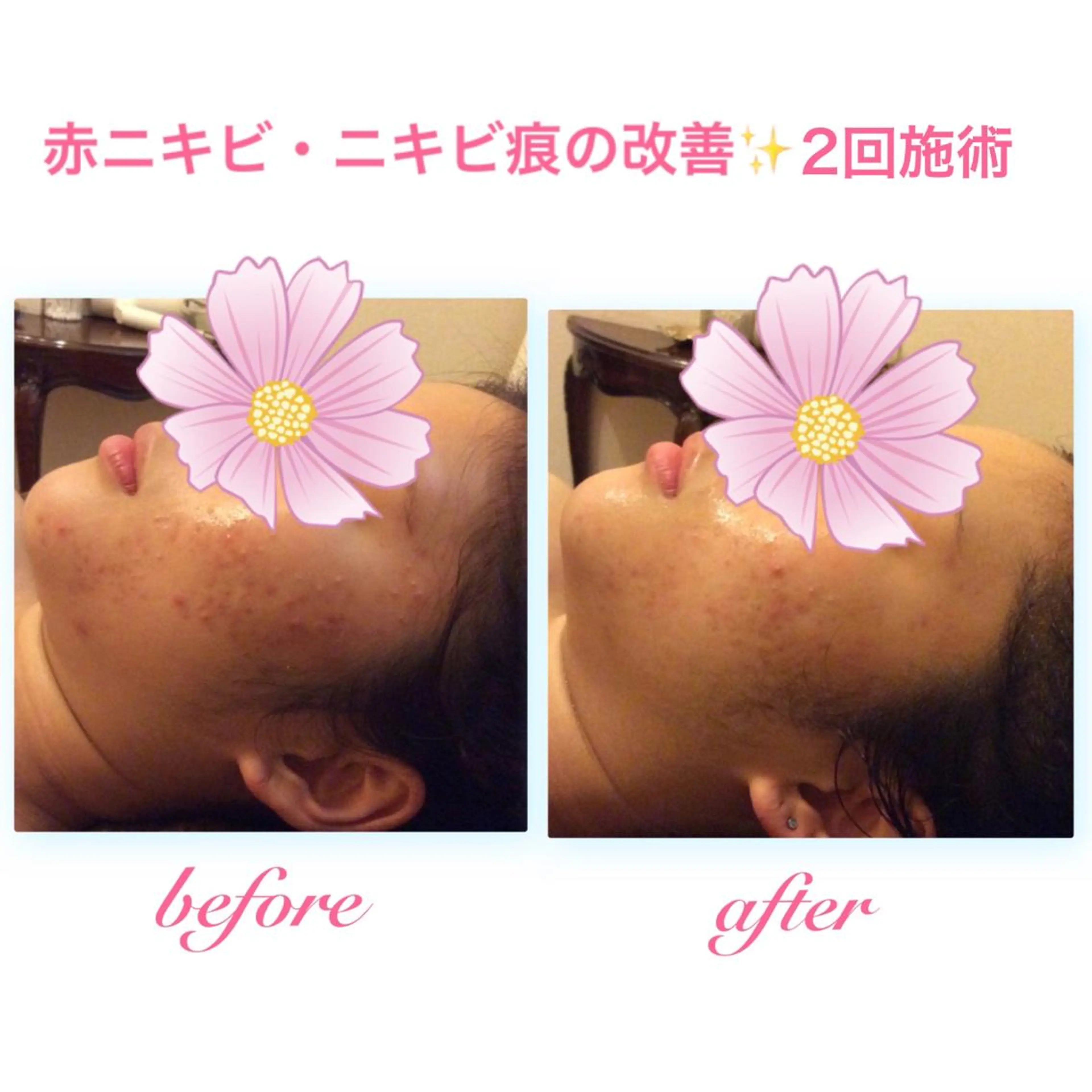 エステ リラク ダイエット・美肌ケア fleurのエステ・リラクイメージ