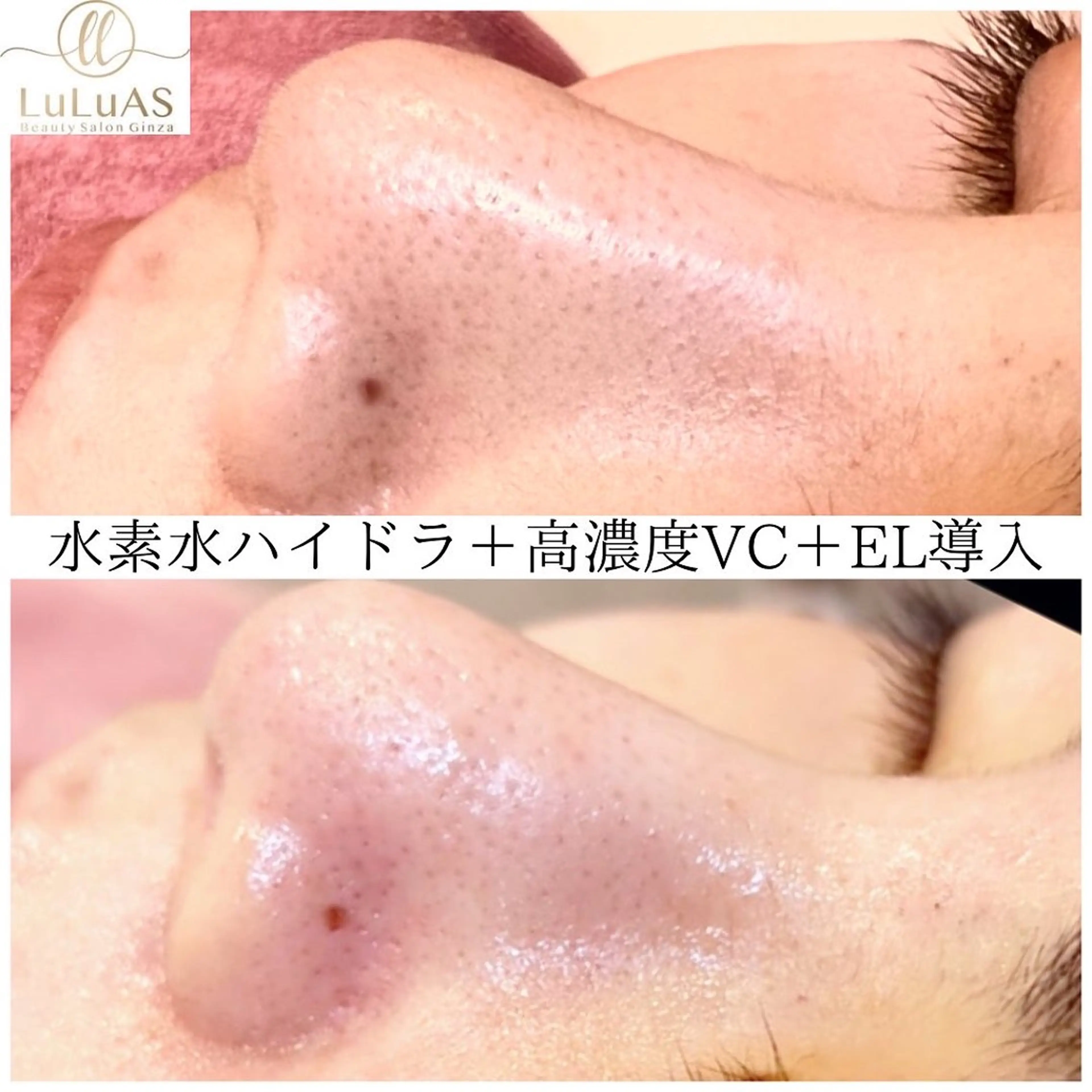 エステ リラク ルルアス GINZAのエステ・リラクイメージ