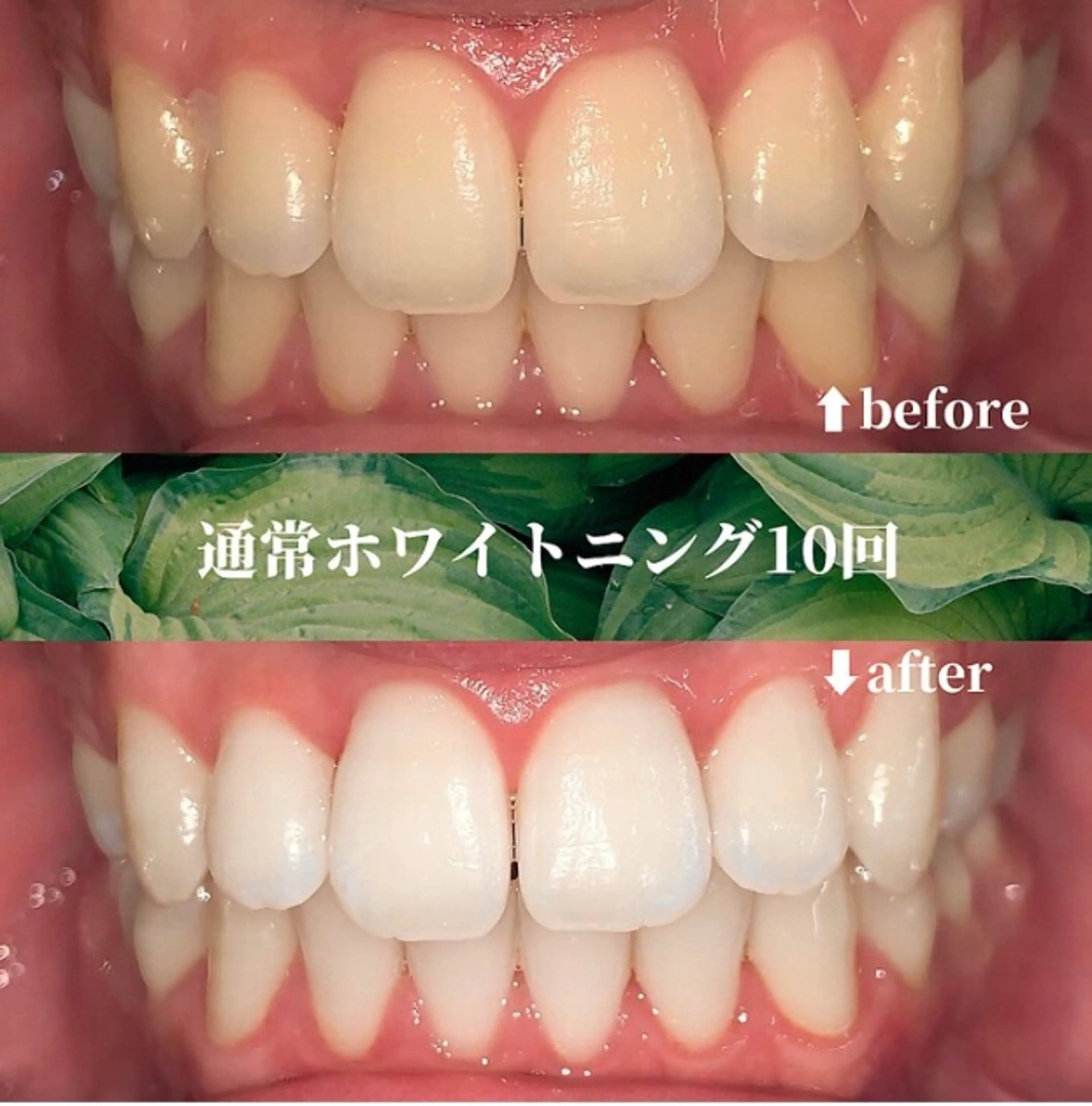 エステ futaba ホワイトニング/天神のエステ・リラクイメージ