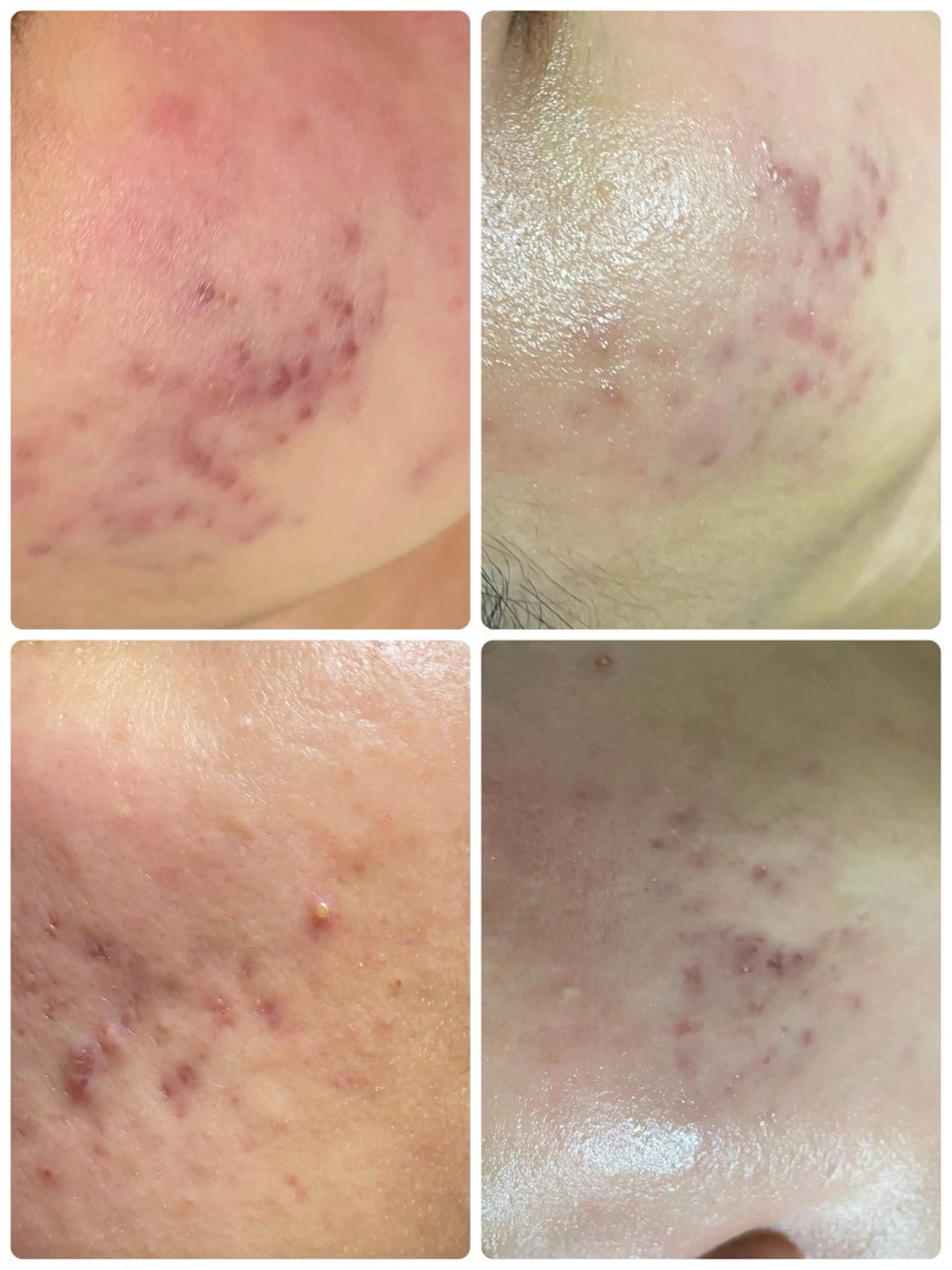 エステ 時枝 瞳のエステ・リラクイメージ