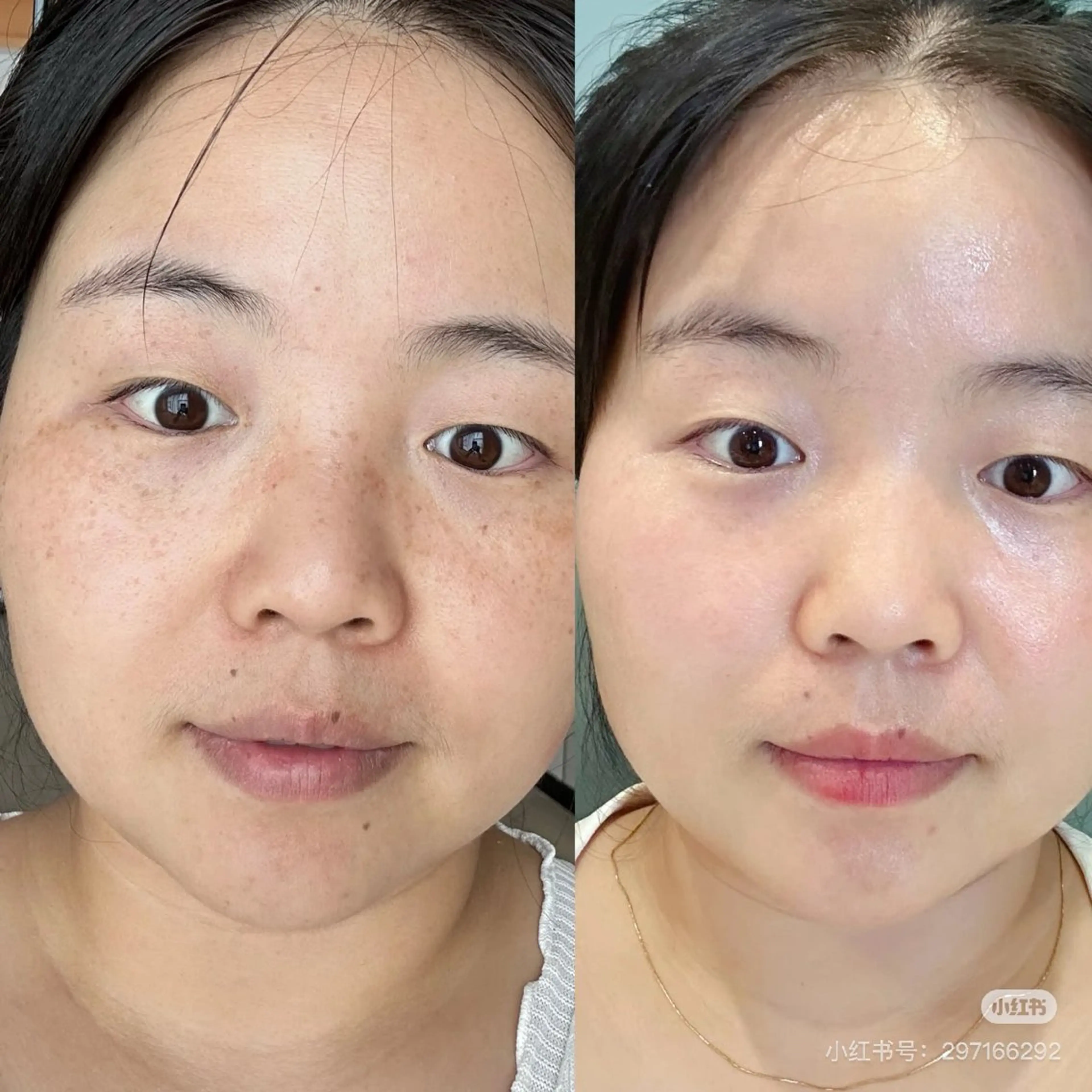 ネイル エステ aliaハイフ&水光ジェットサロン所属・aliaハーブ水光店 エステティシャン募集のエステ・リラクイメージ