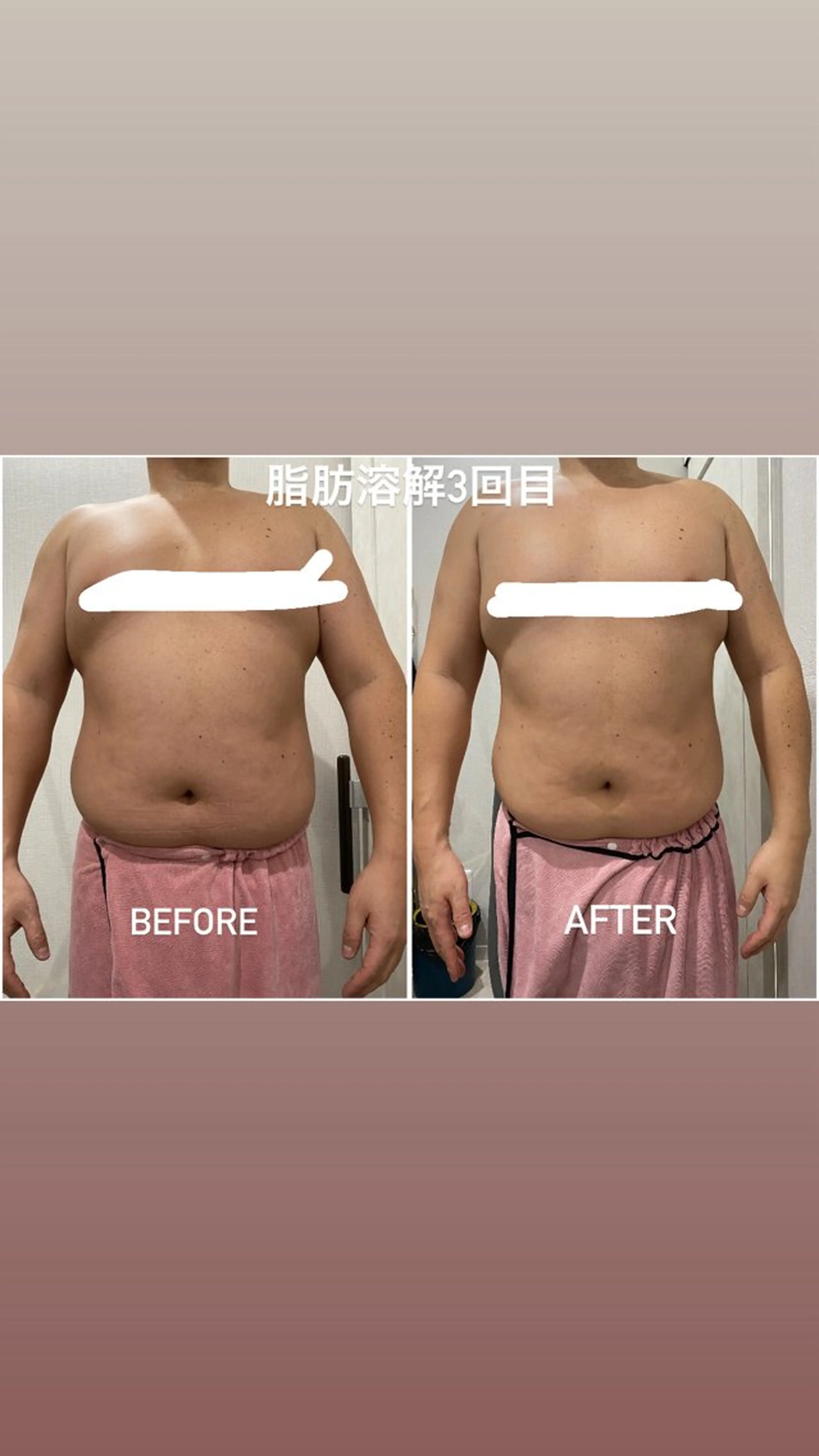 エステ 毛穴洗浄・痩身・脱毛 /アルカンジュのエステ・リラクイメージ