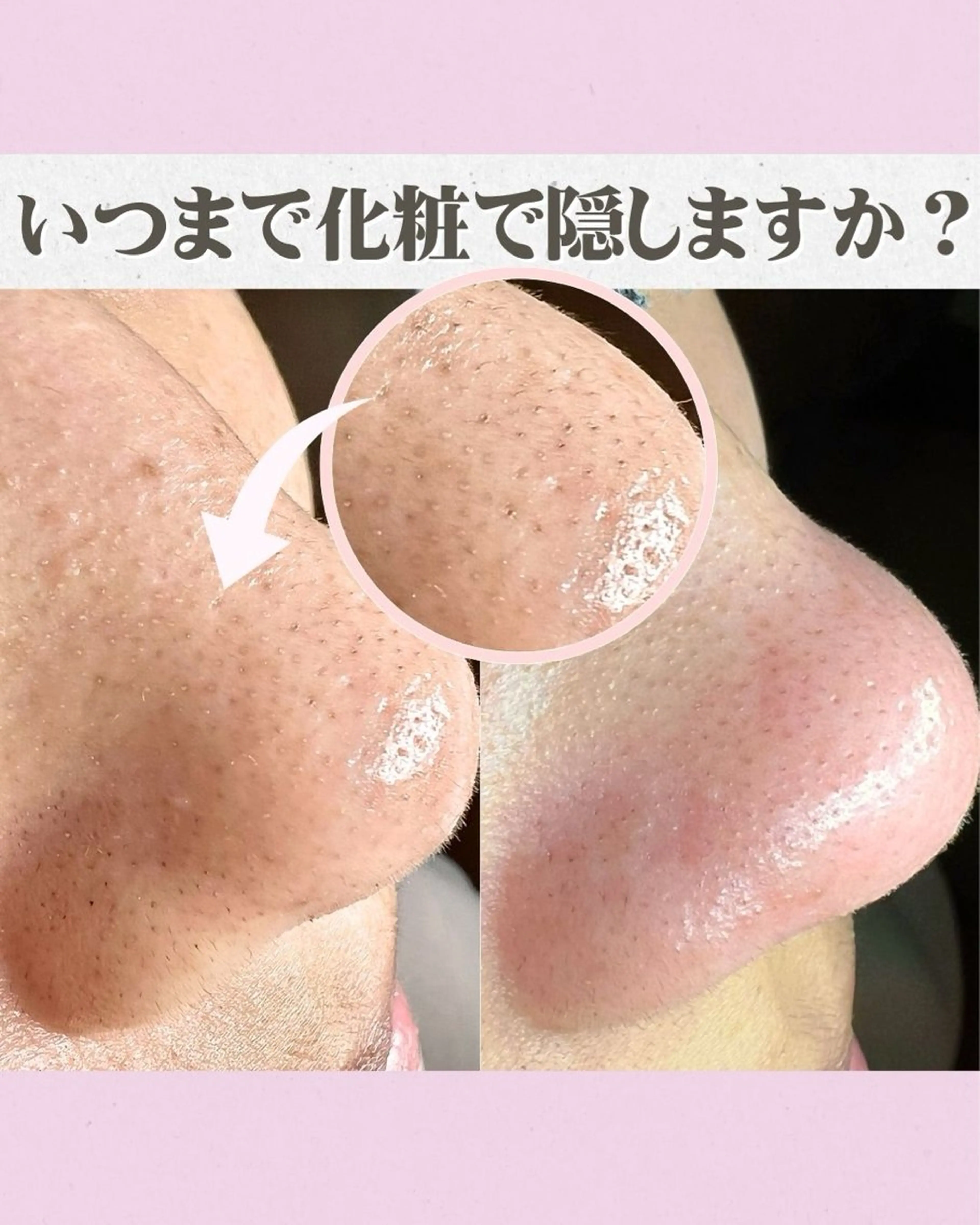 エステ Muqu.所属・Muqu. 毛穴サロンのエステ・リラクイメージ