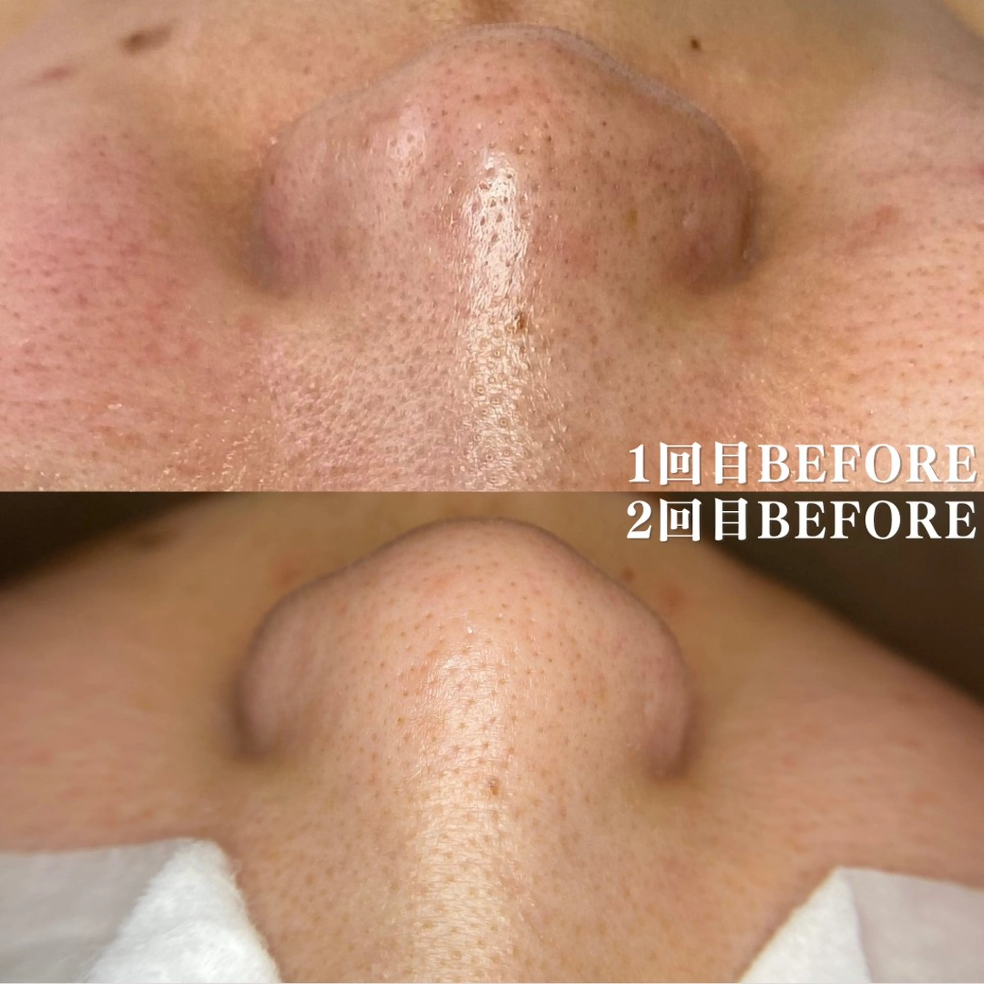 エステ salon MUSUBUのエステ・リラクイメージ