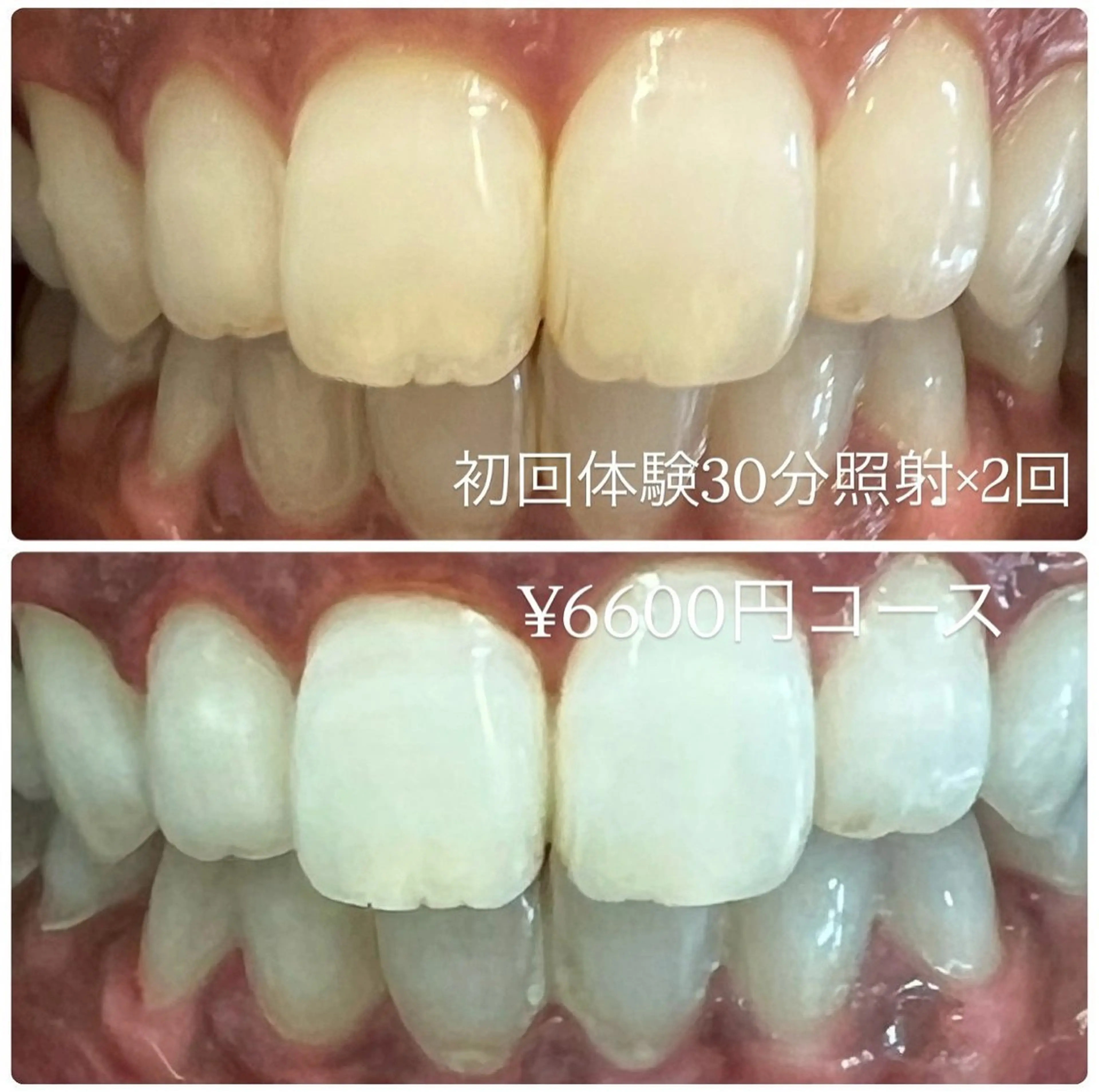 その他 PLATINUM Beauty 横浜店所属・ホワイトニングルーム 横浜店のその他イメージ