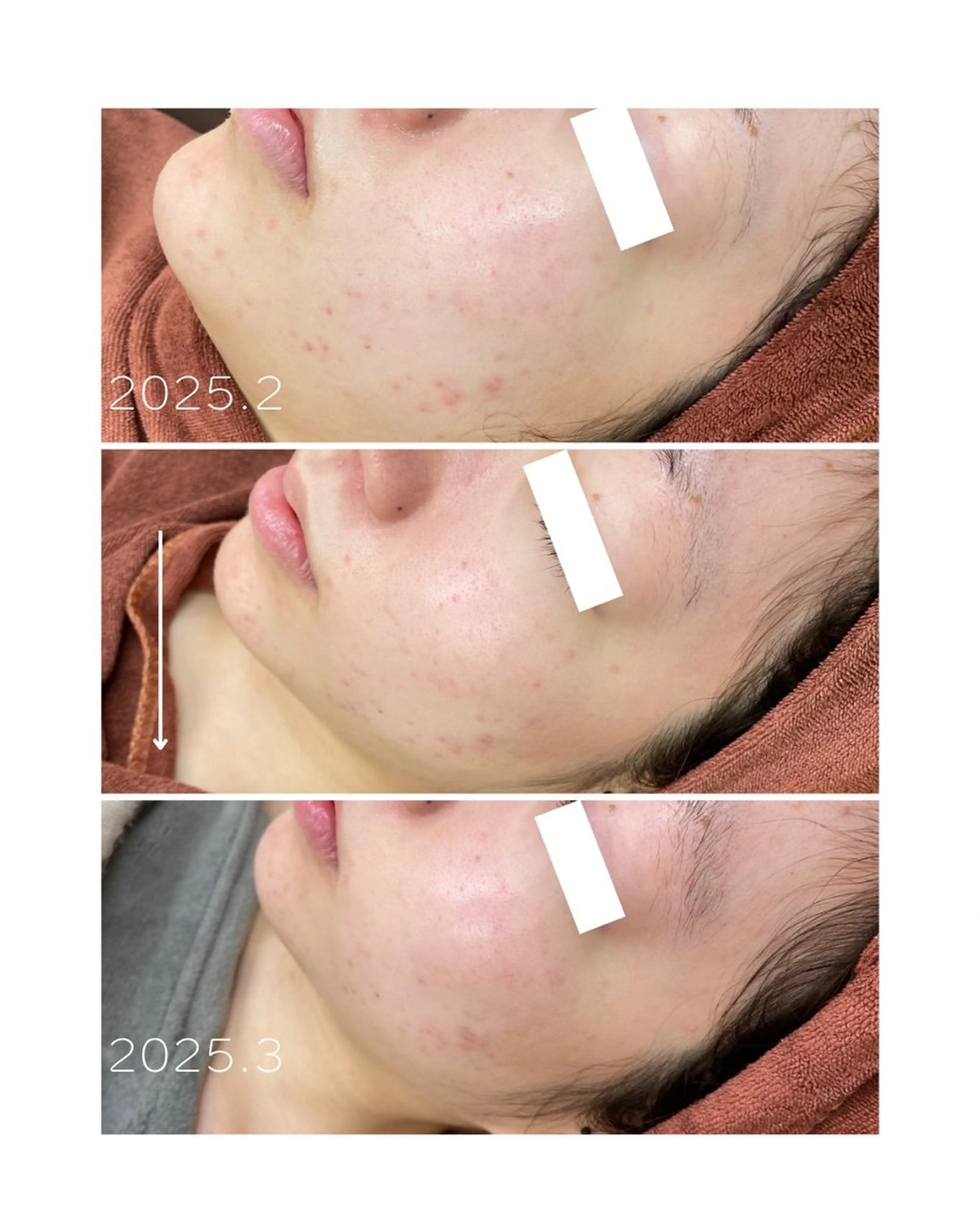 エステ 肌質改善ワックス専門 yukiのエステ・リラクイメージ