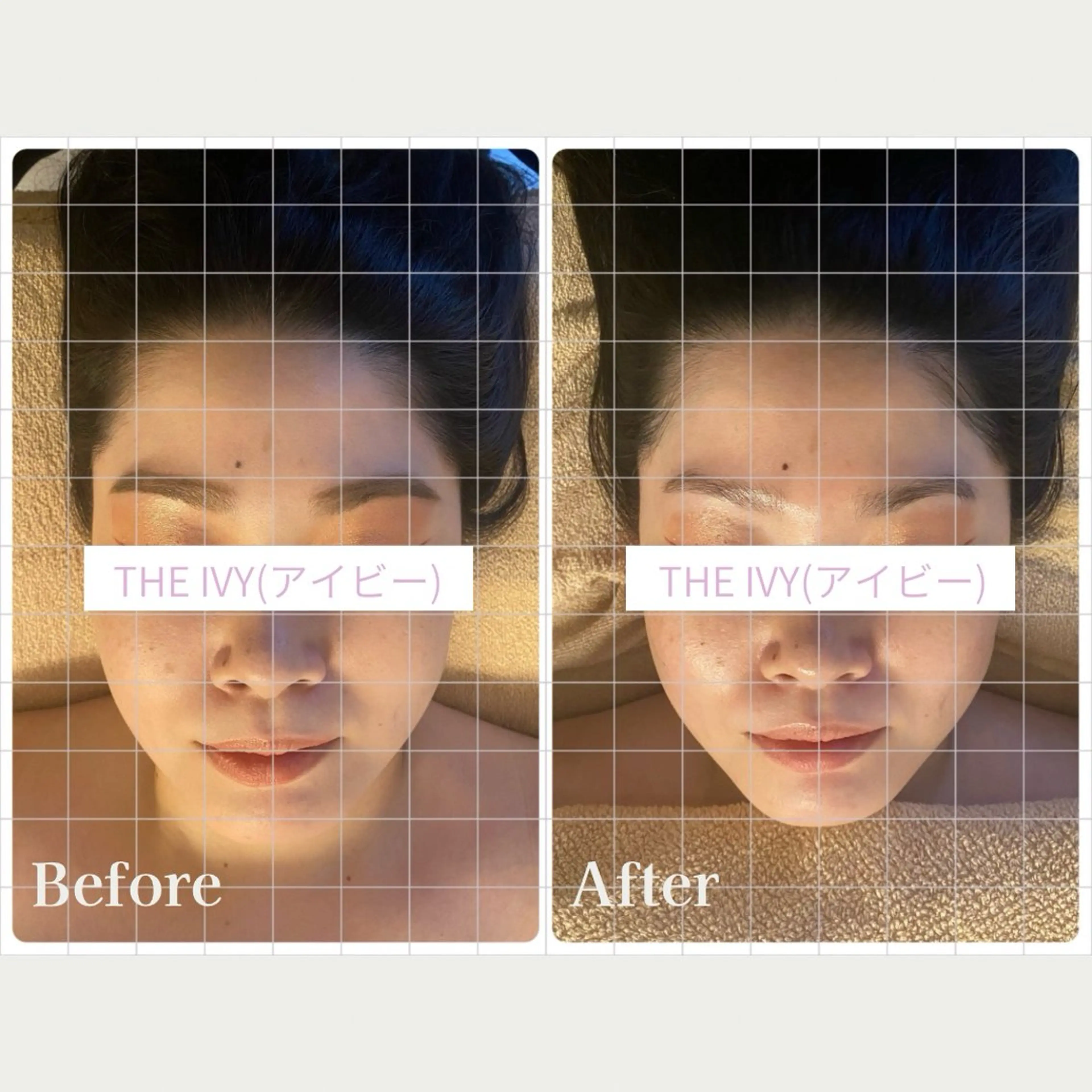 ＼脳疲労ケア75分／【ドライヘッドスパ・耳・首・肩・顔・デコルテ・背中・二の腕】 +美肌ケア★イオン導入付きの写真