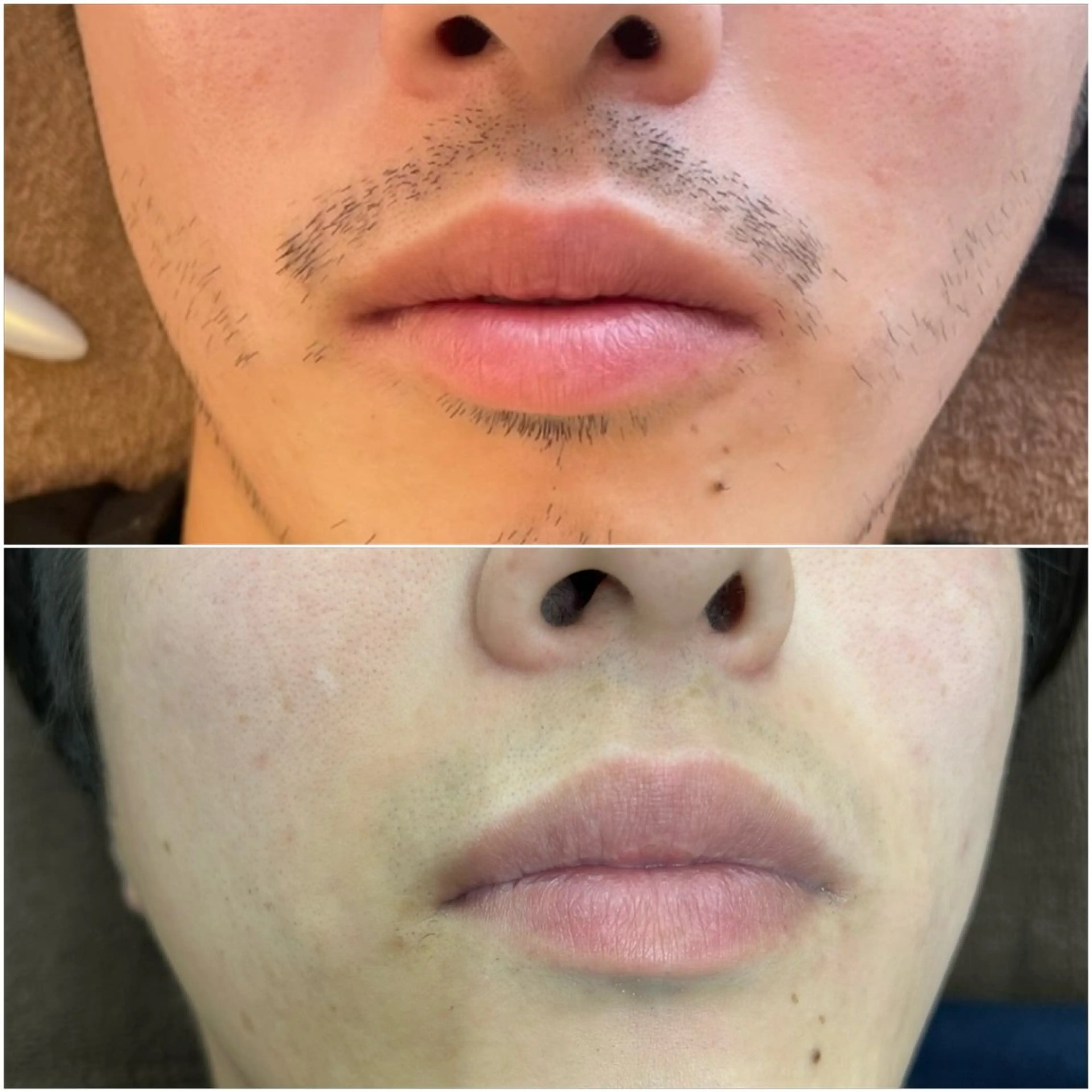 エステサロンMee. 大畑のエステ・リラクイメージ