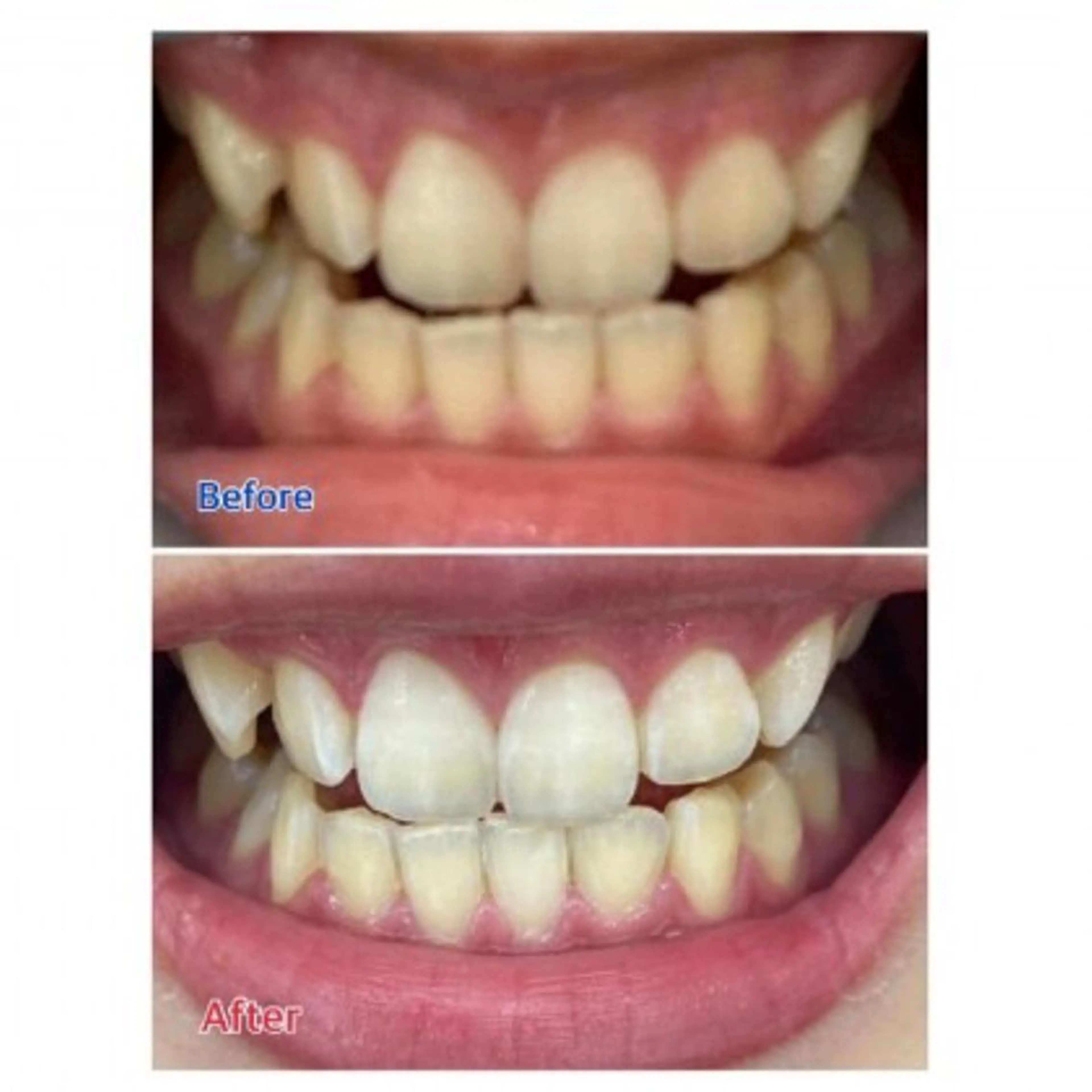 M渋谷店所属・Ｍ渋谷 ホワイトニングのエステ・リラクイメージ