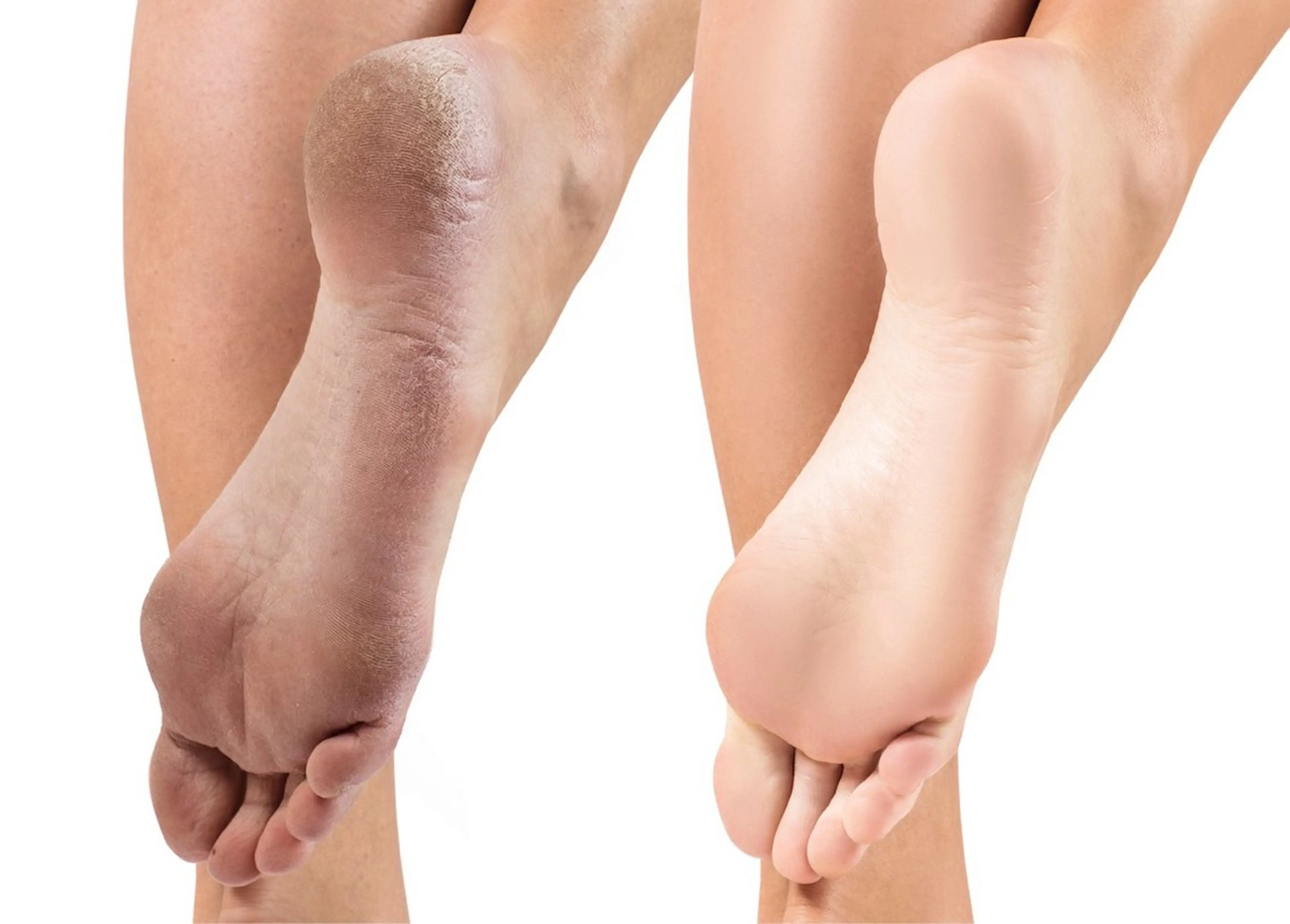 ネイル エジラランテ esilaranteのエステ・リラクイメージ