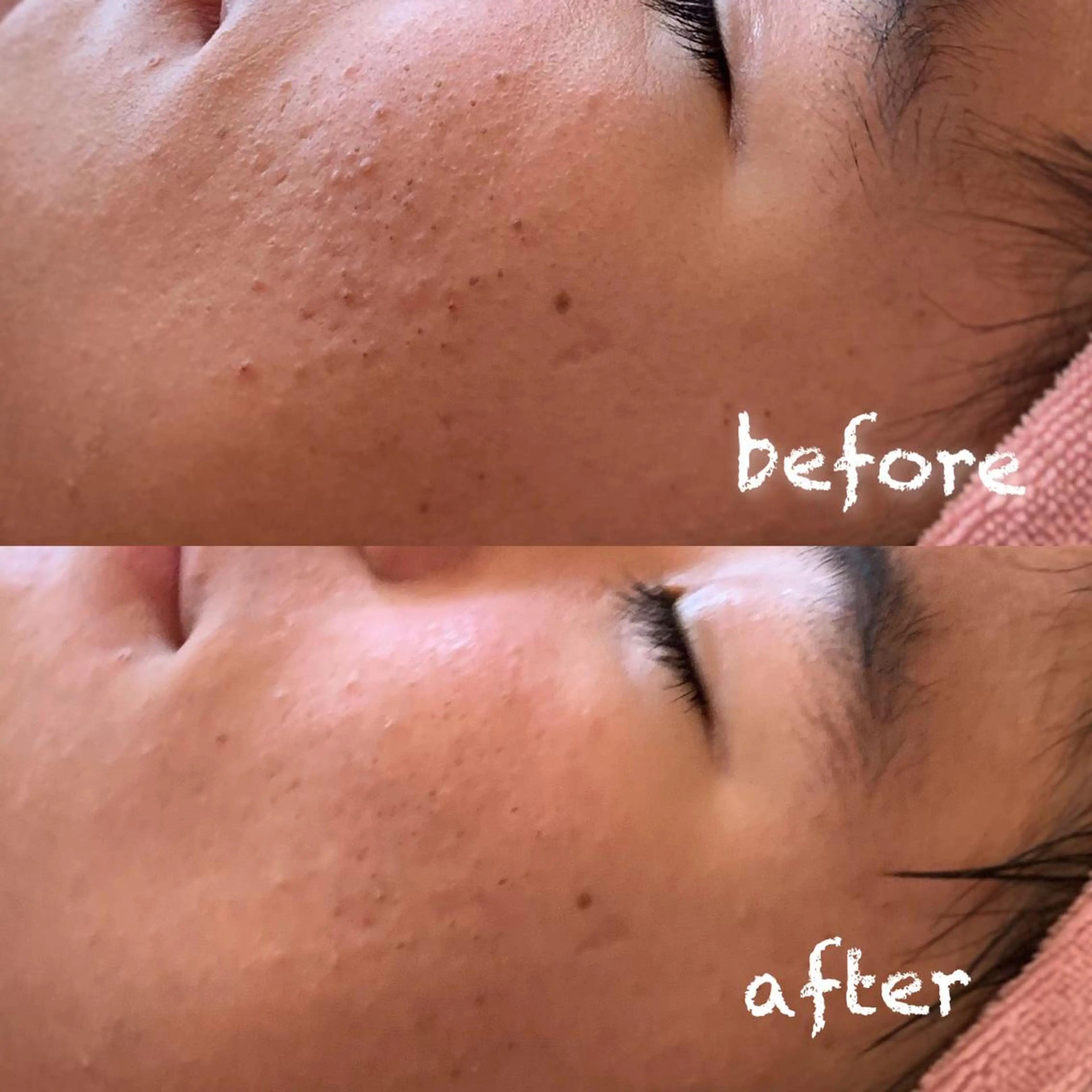 美肌蘇生カウンセラー 横山りえのエステ・リラクイメージ