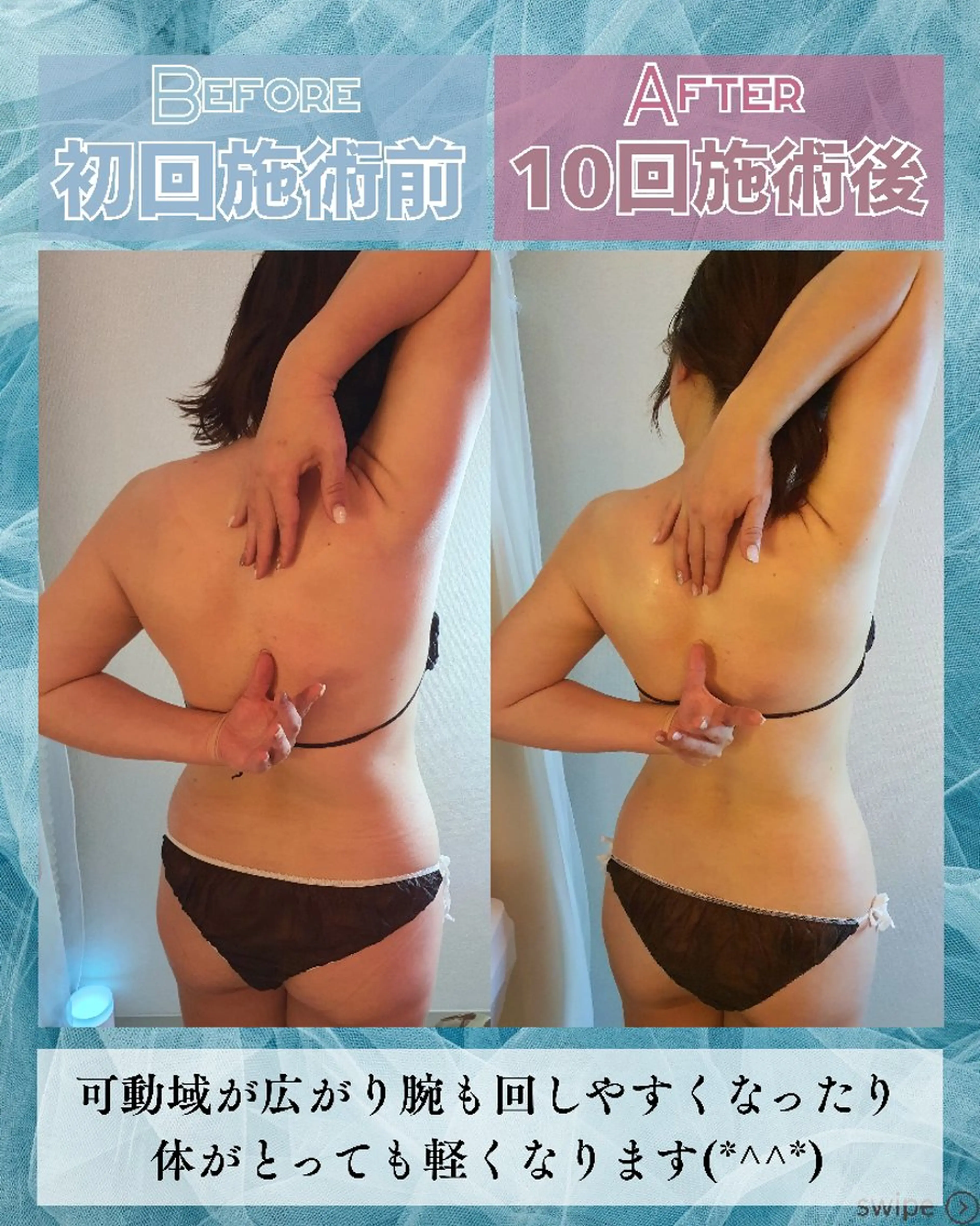 エステ リラク 痩身ハーブピーリング 筋膜リリース☆B&Hのエステ・リラクイメージ