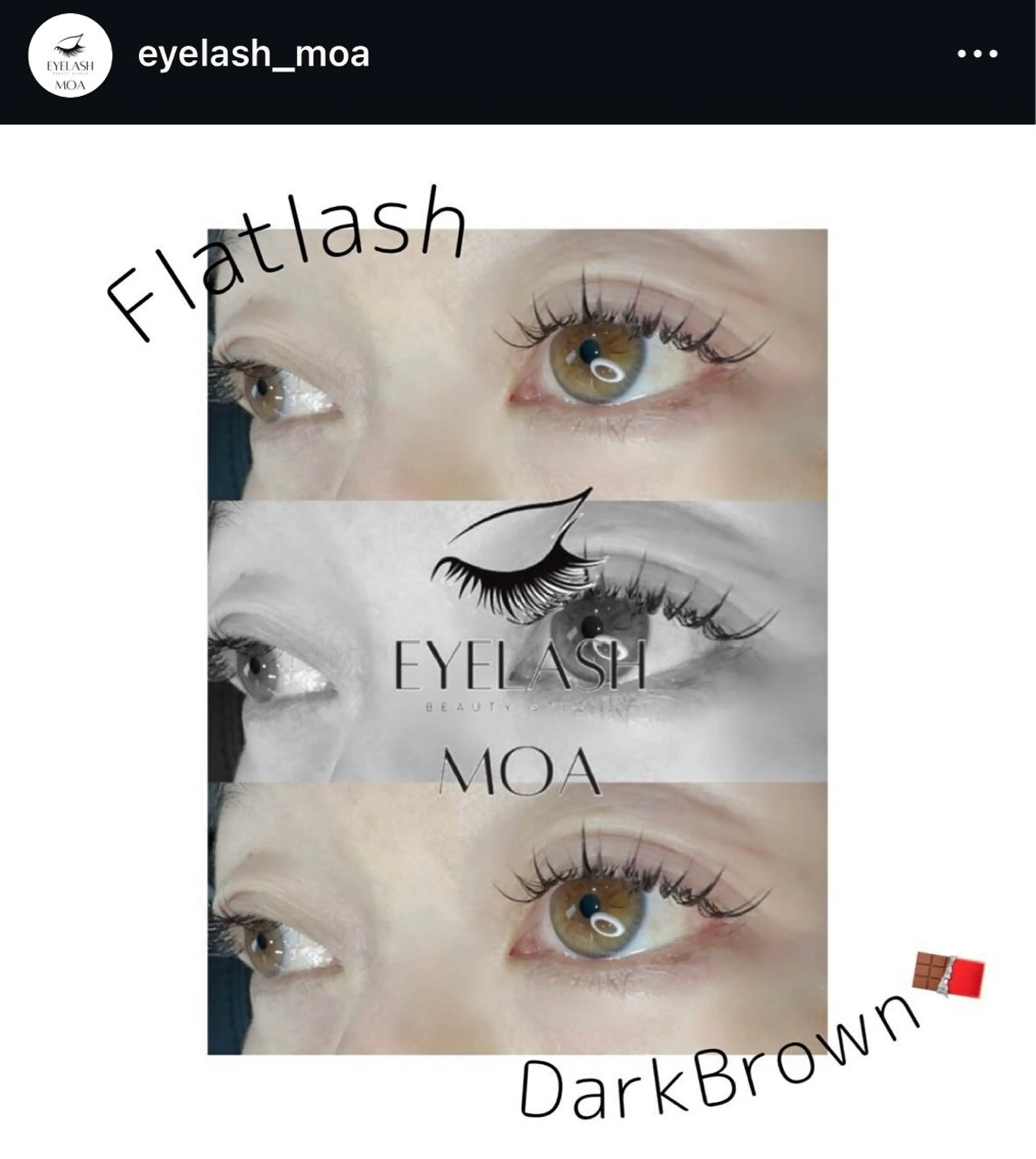 フラットラッシュ：（両目）60本の写真