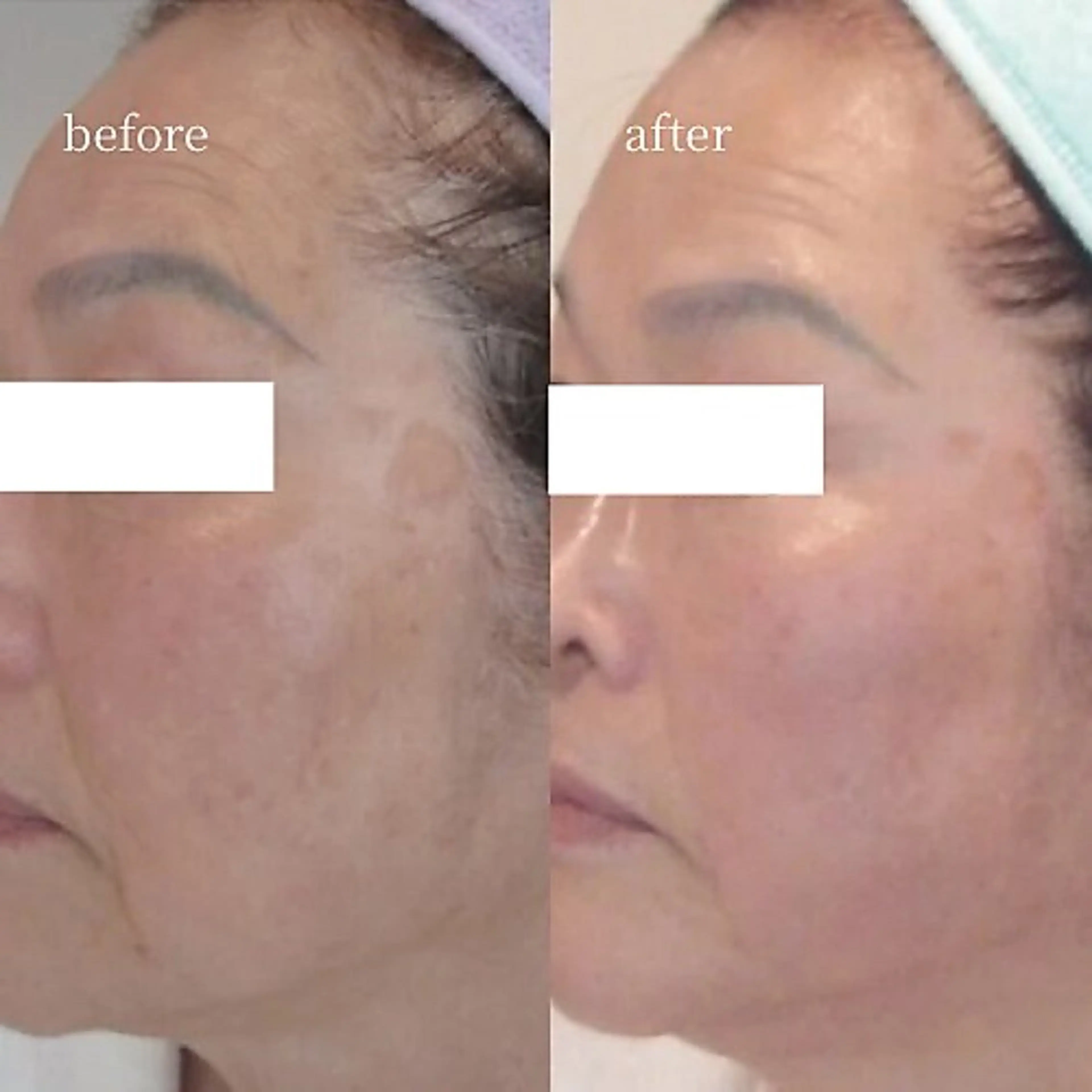 エステ 韓国肌管理・肌質改善 EARNEST心斎橋のエステ・リラクイメージ