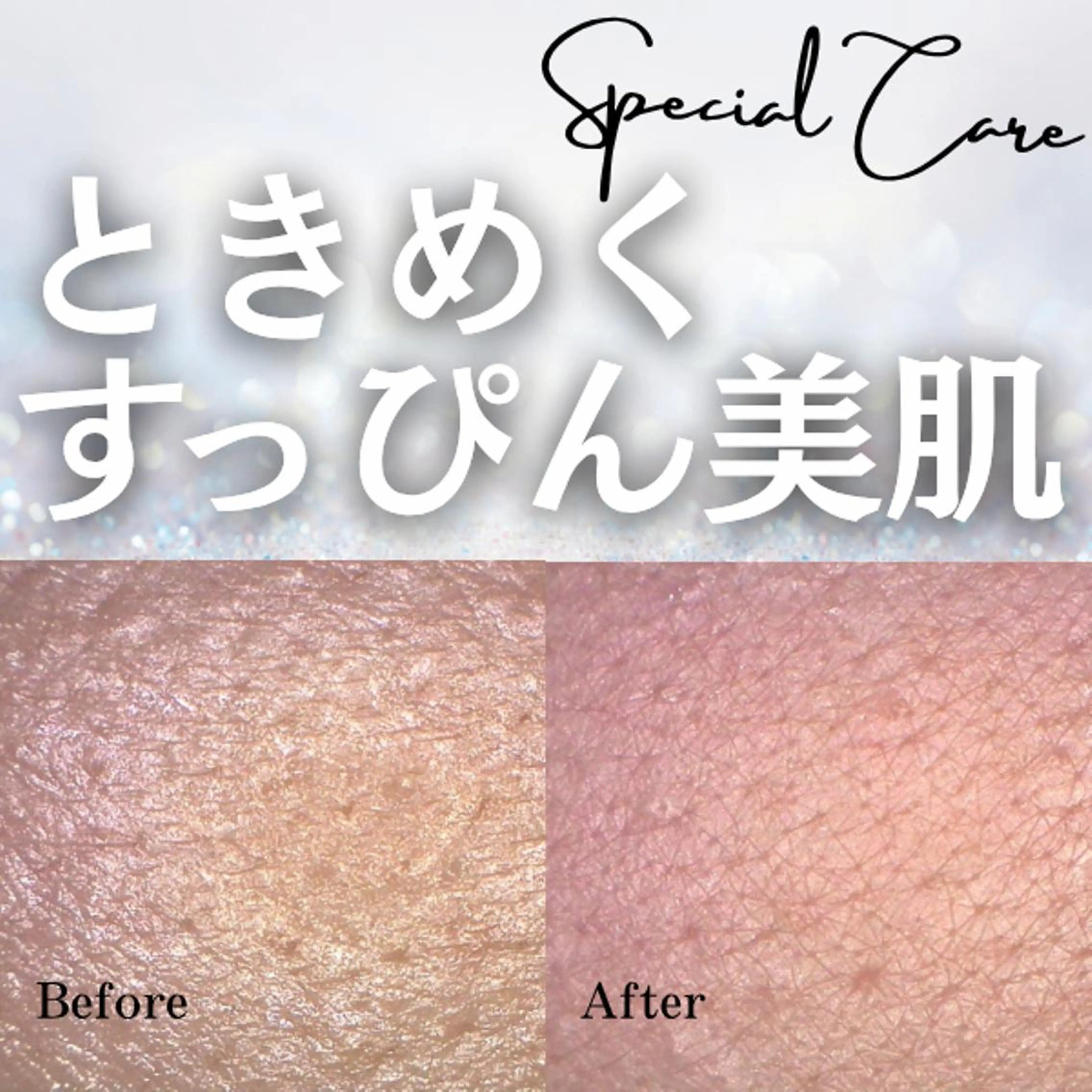 【30代に多い肌トラブルを改善】シミ・乾燥・毛穴の開きが気になる方に。の写真