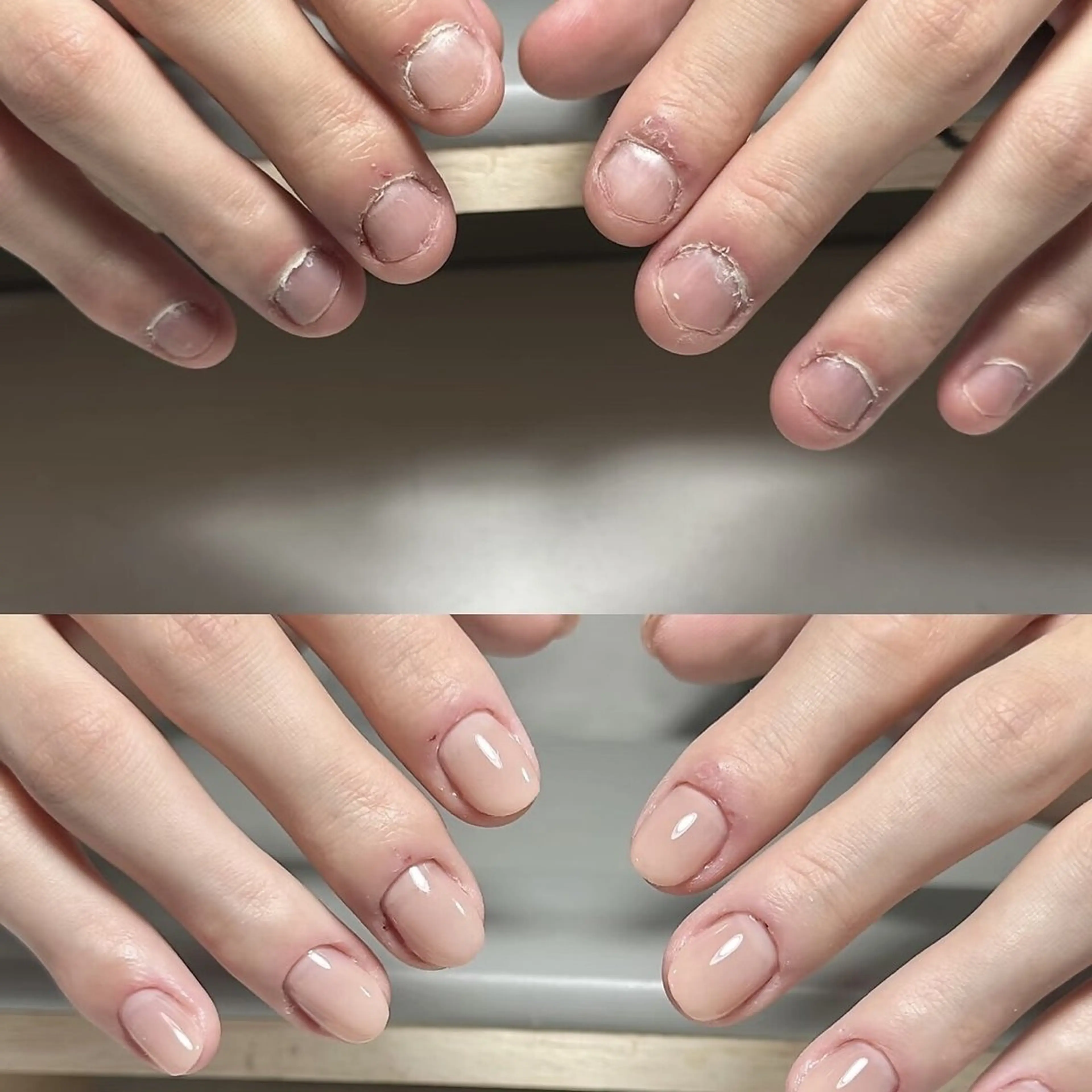 【深爪噛爪】矯正コース★長さ出しのみ＊¥ 8000円の写真