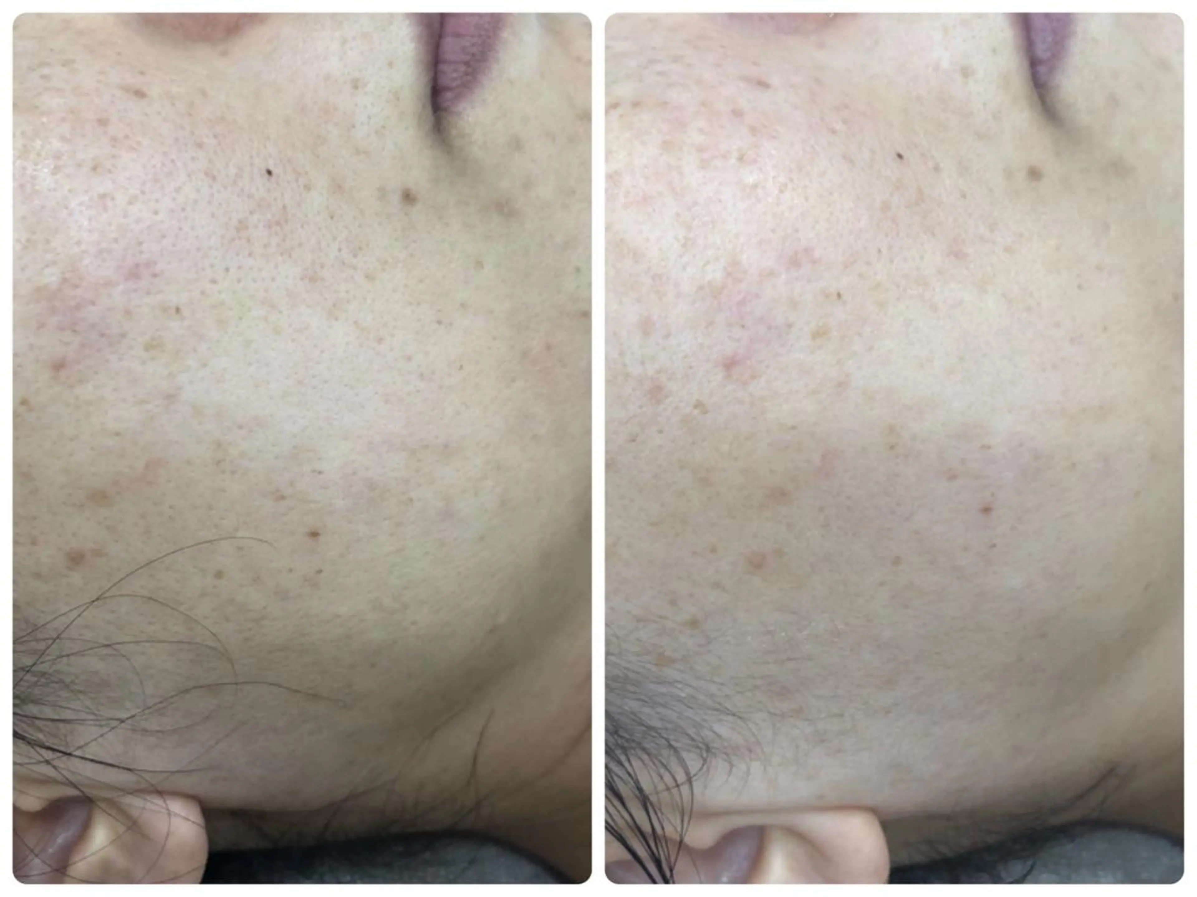 宮野 麻綺のエステ・リラクイメージ