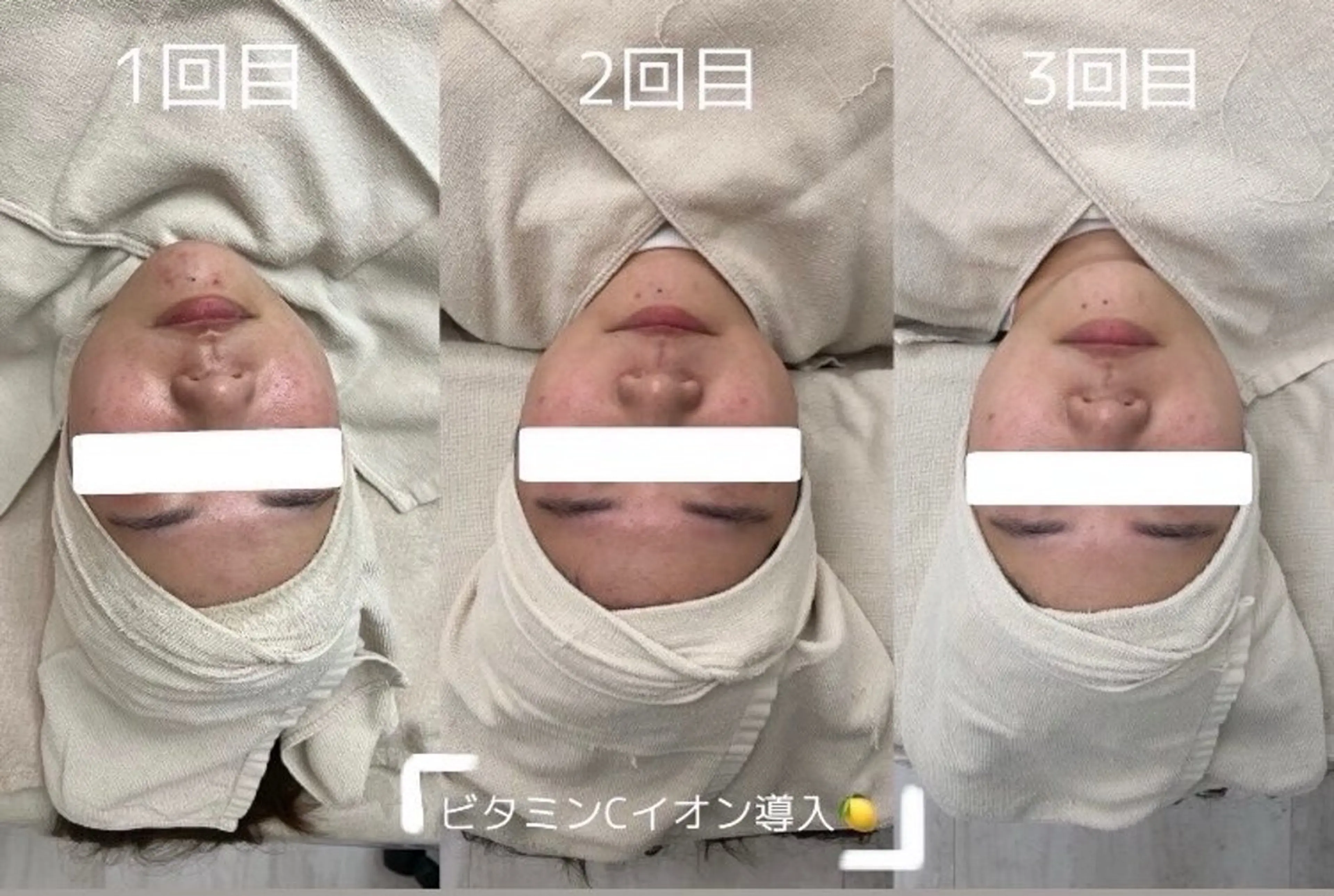 BITSU　PRESS原宿所属・PRESS 中山のエステ・リラクイメージ