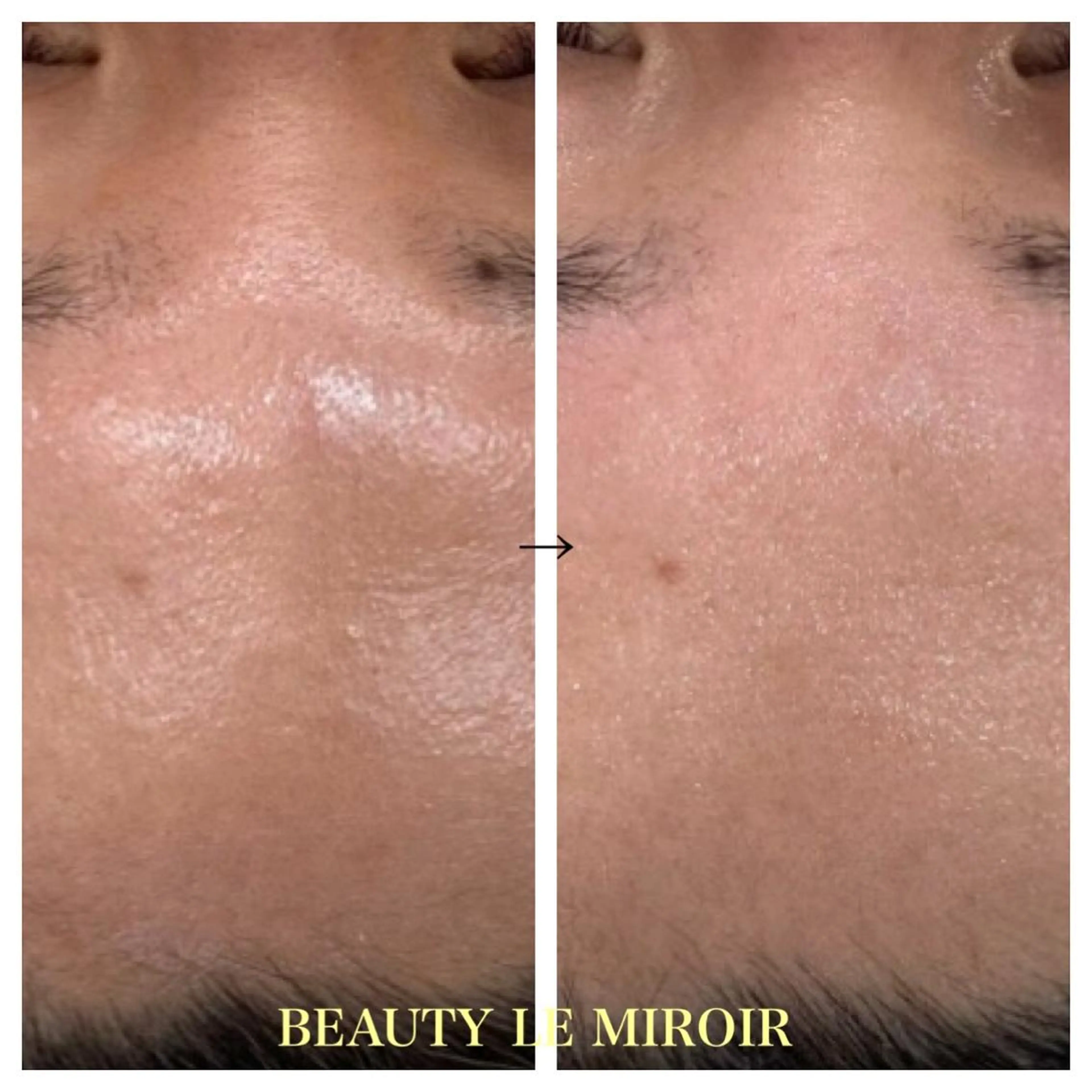 ビューティー ミロワールのエステ・リラクイメージ